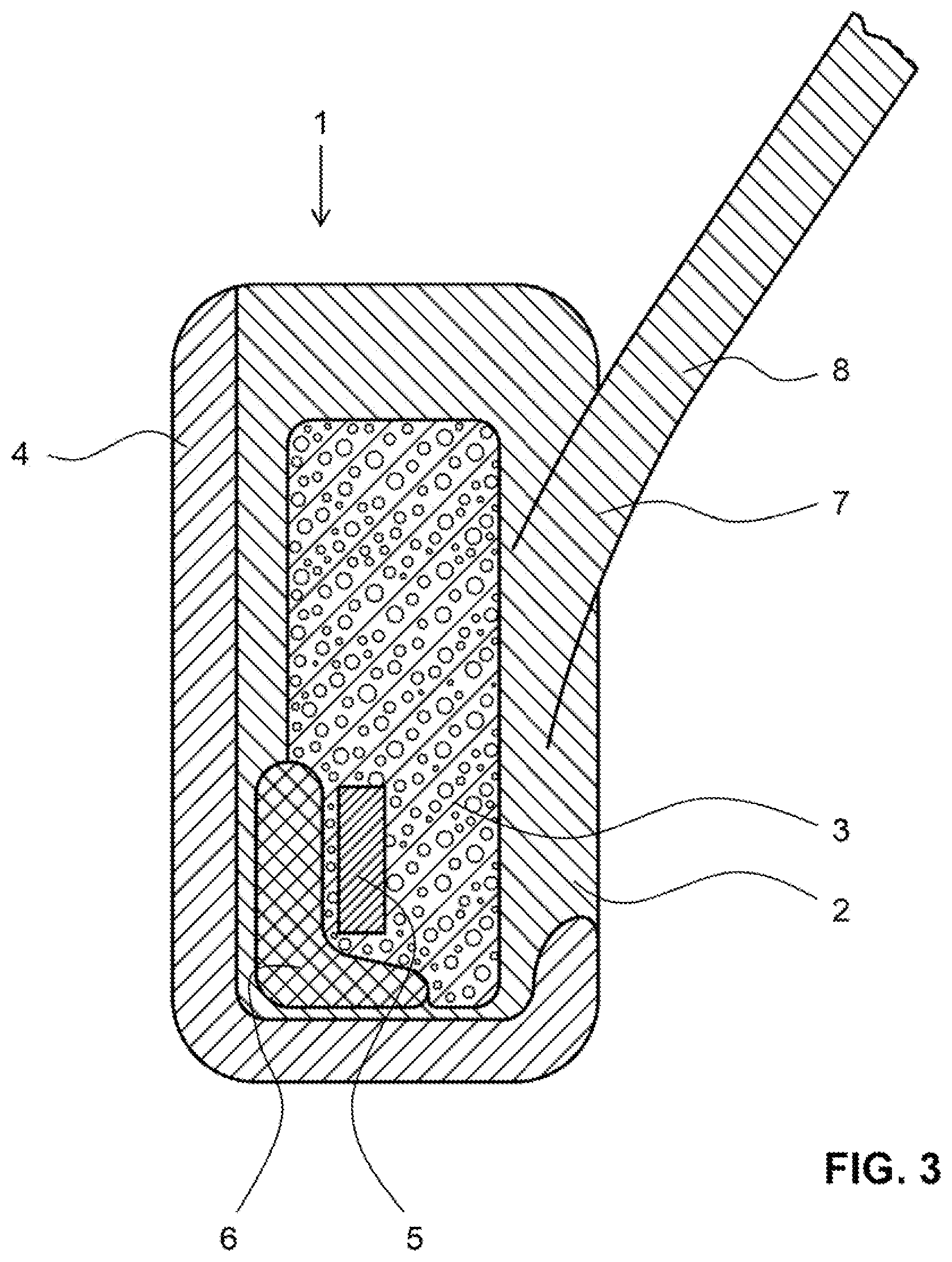 Patent US12303749 Figure 3 – Golf club head and golf club