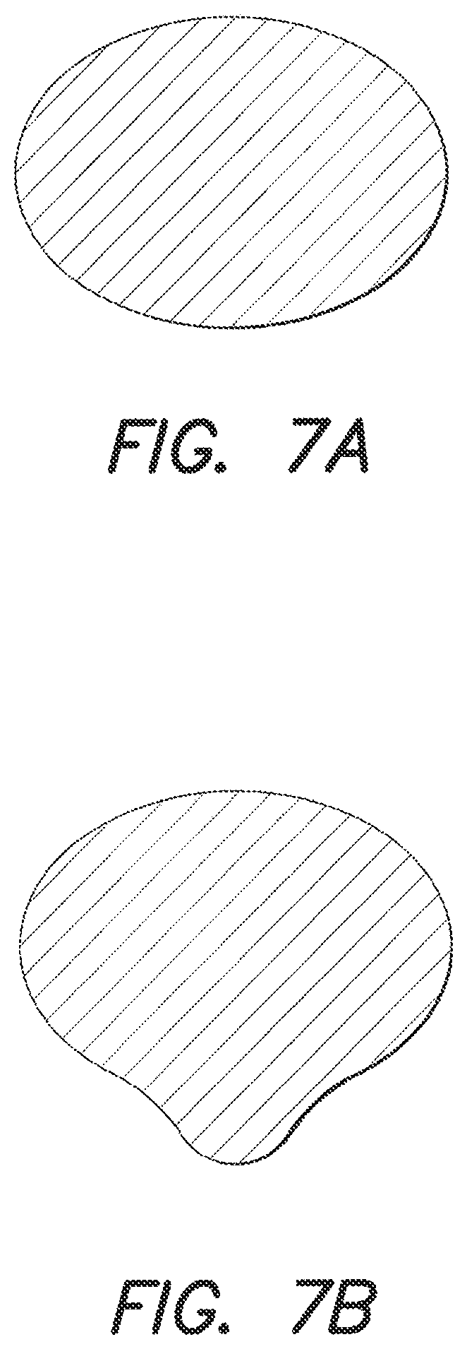 Patent US12303756 Figure 20 – Baseball bat