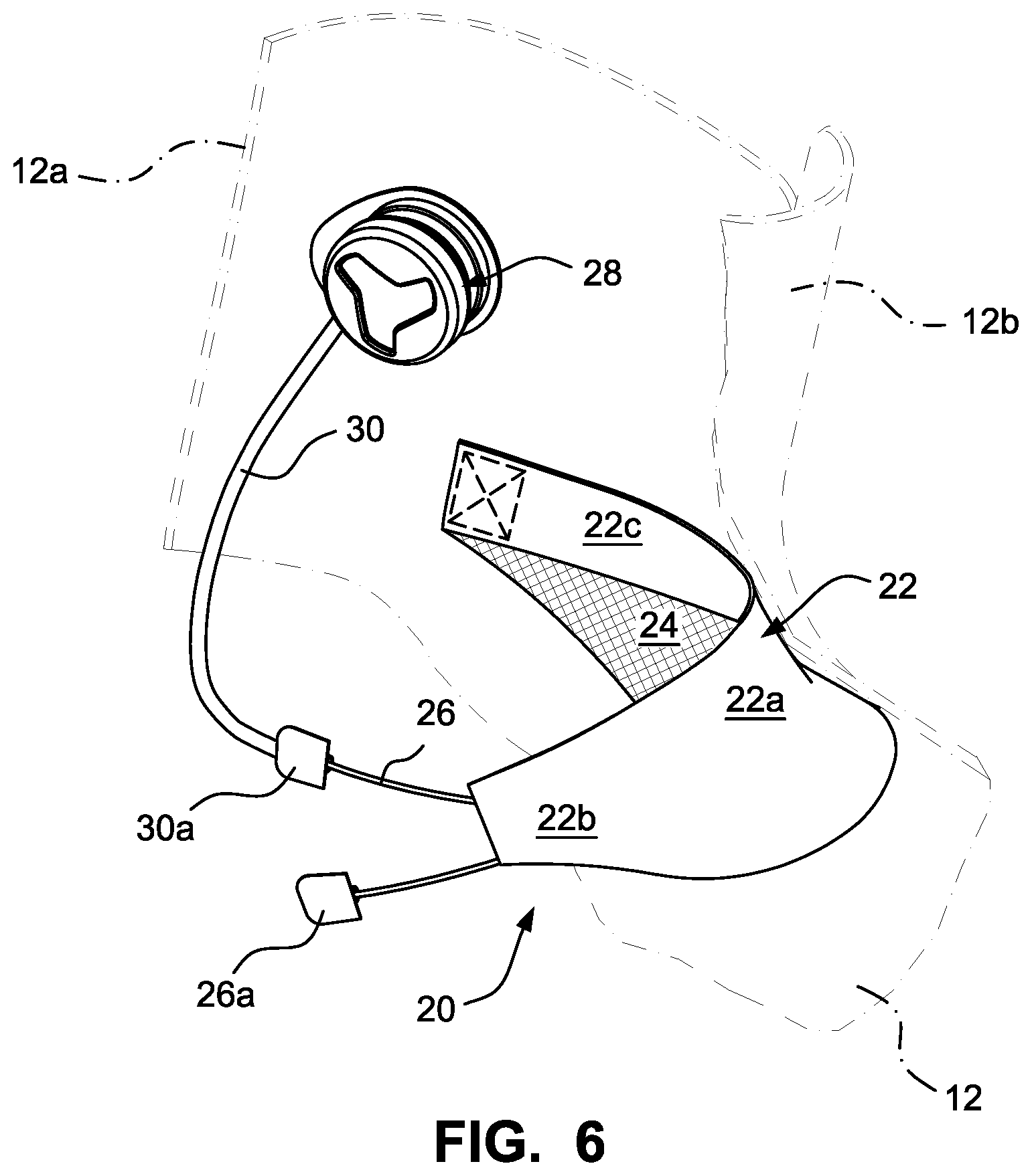 Patent US12303768 Figure 6 – Sports boot with integrated ankle compression system