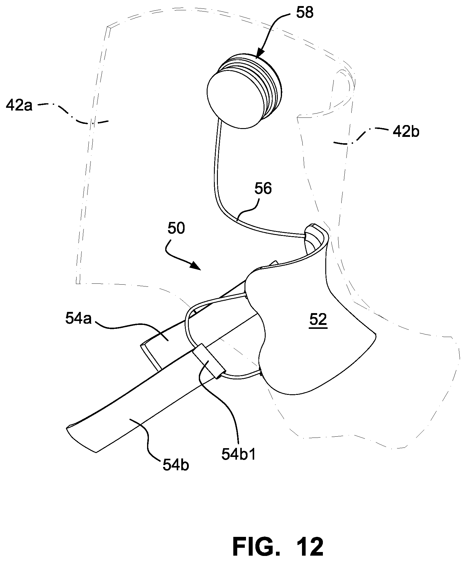 Patent US12303768 Figure 12 – Sports boot with integrated ankle compression system
