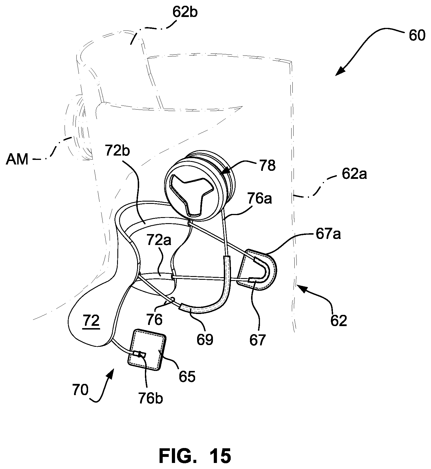Patent US12303768 Figure 15 – Sports boot with integrated ankle compression system