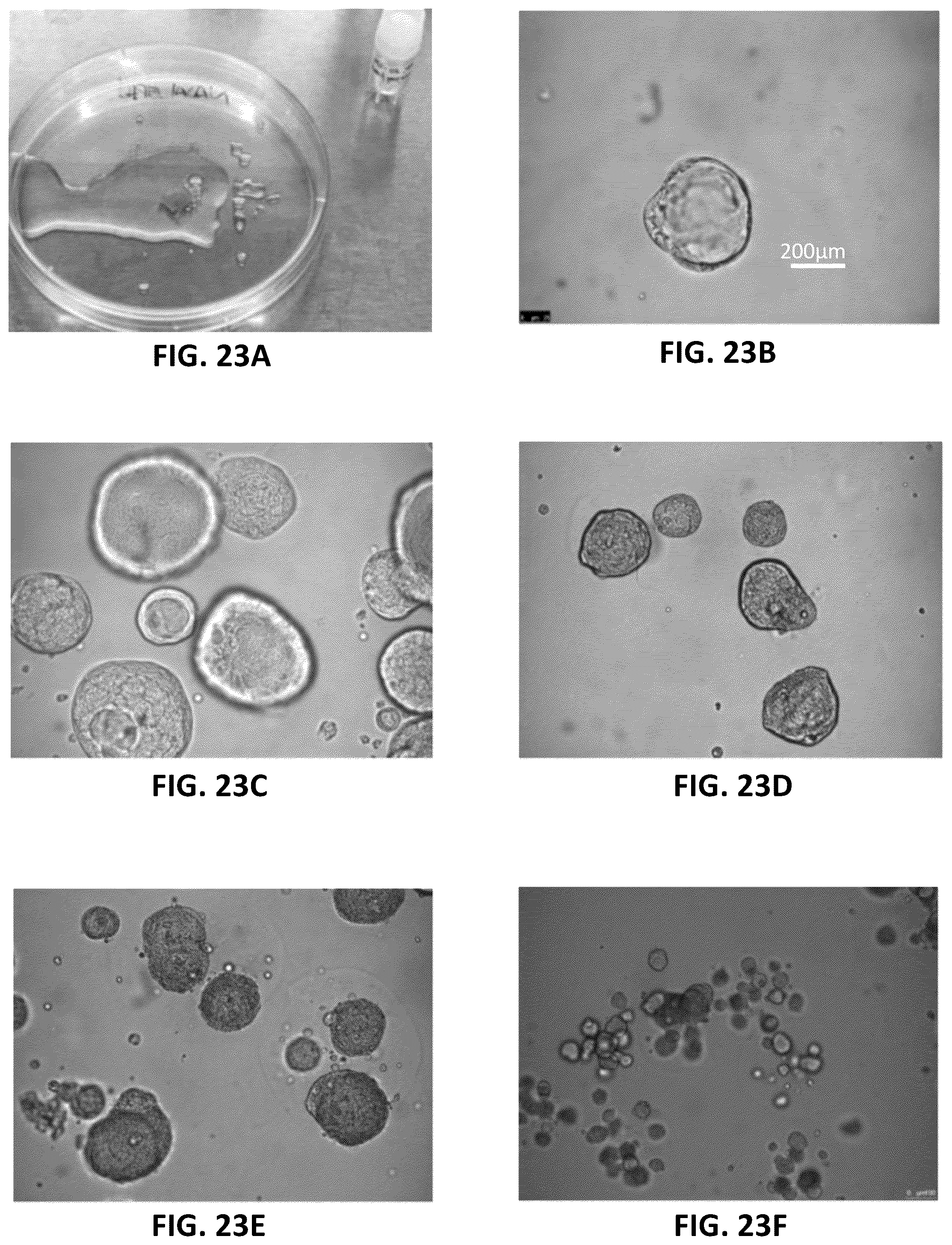 Patent US12303806 Figure 11 – Apparatuses for purification of gel droplets supporting biological tissue