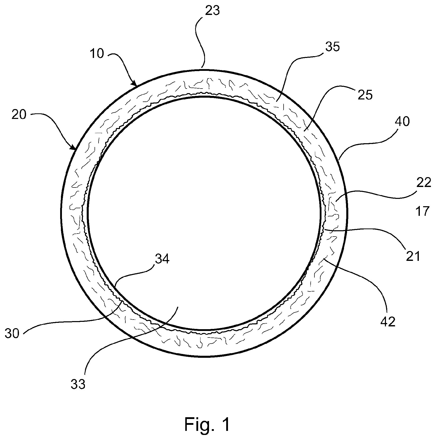 Patent US12304135 Figure 1 – Construction of tubular assemblies