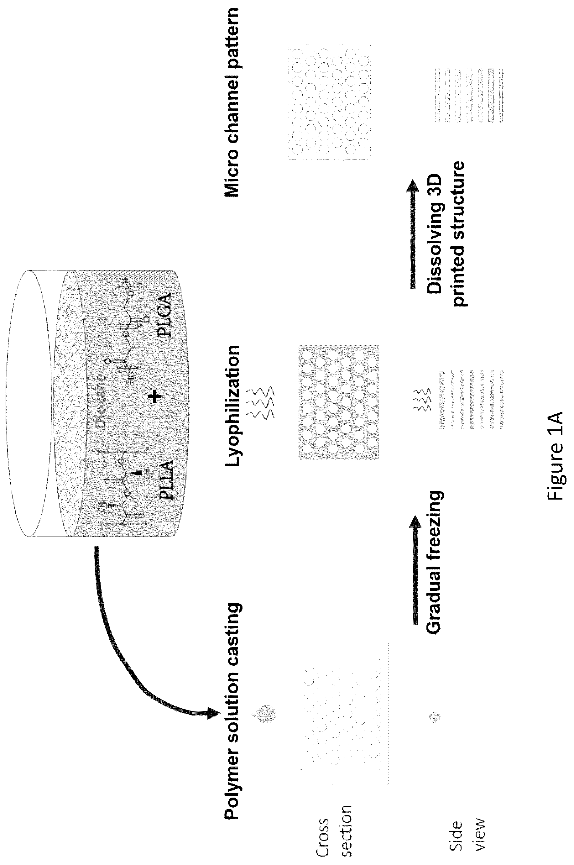 Patent US12304151 — 3D printed biodegradable implants — Figure 1