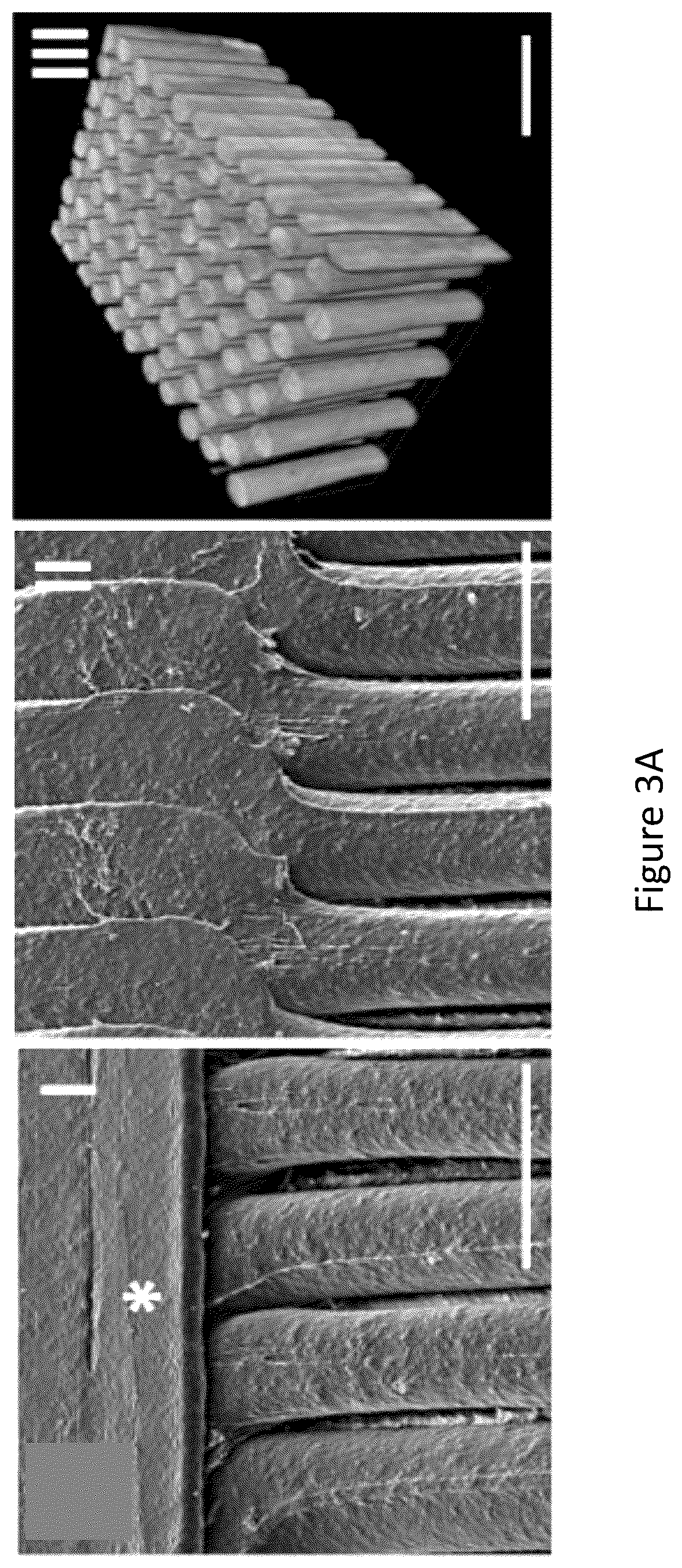 Patent US12304151 Figure 5 – 3D printed biodegradable implants