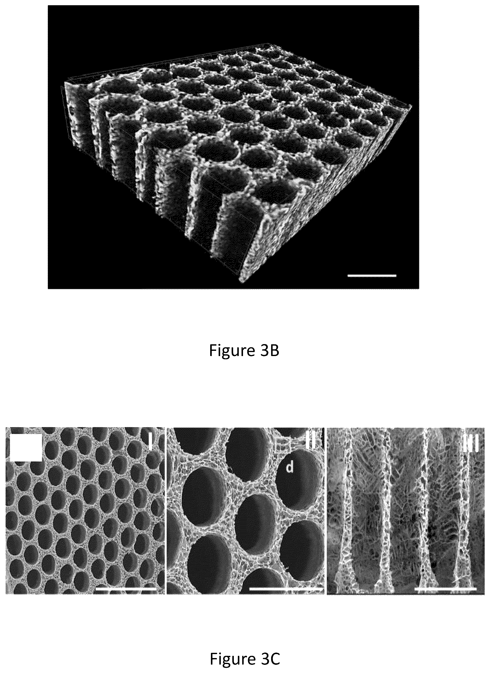 Patent US12304151 Figure 6 – 3D printed biodegradable implants