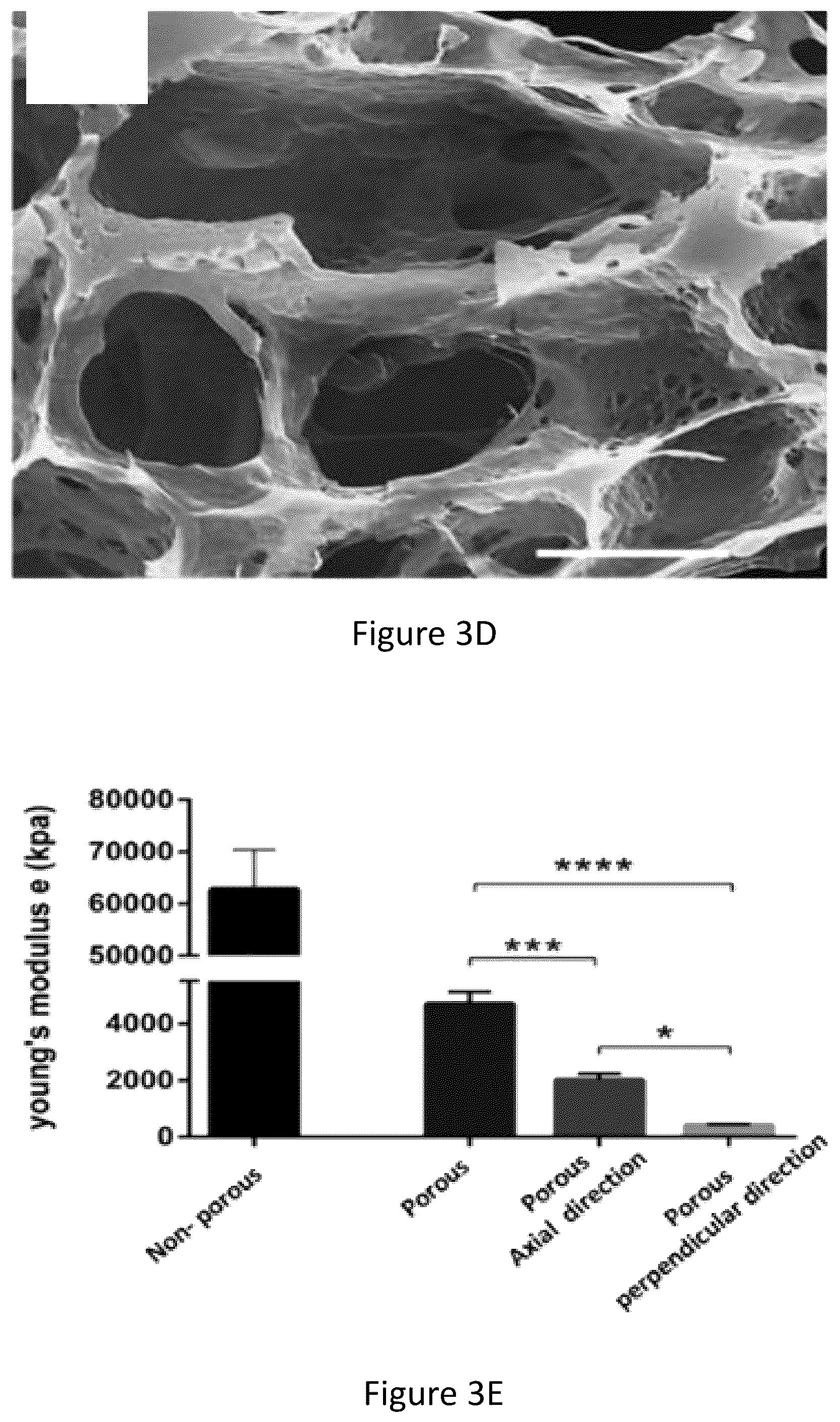 Patent US12304151 Figure 7 – 3D printed biodegradable implants