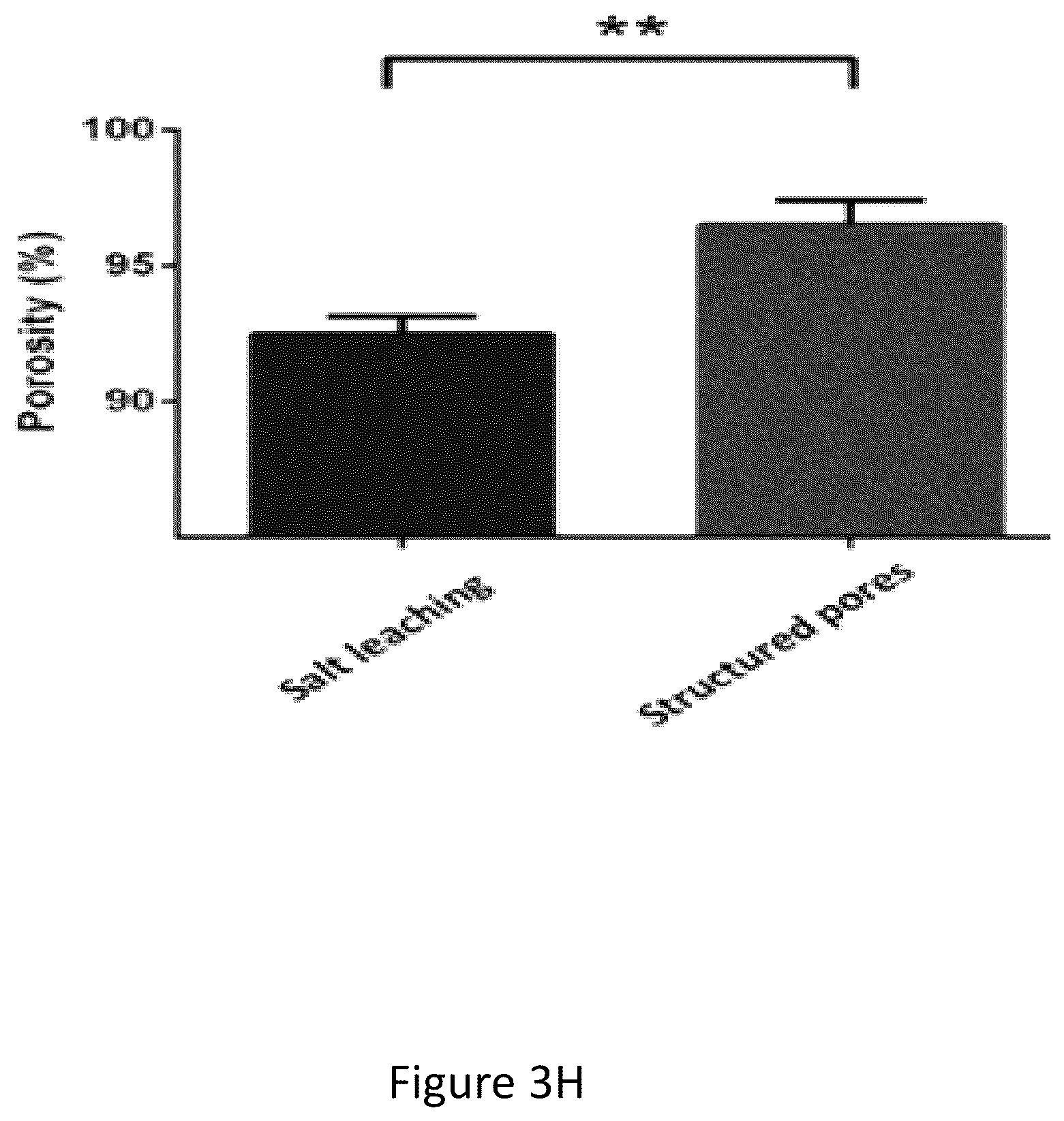 Patent US12304151 Figure 10 – 3D printed biodegradable implants
