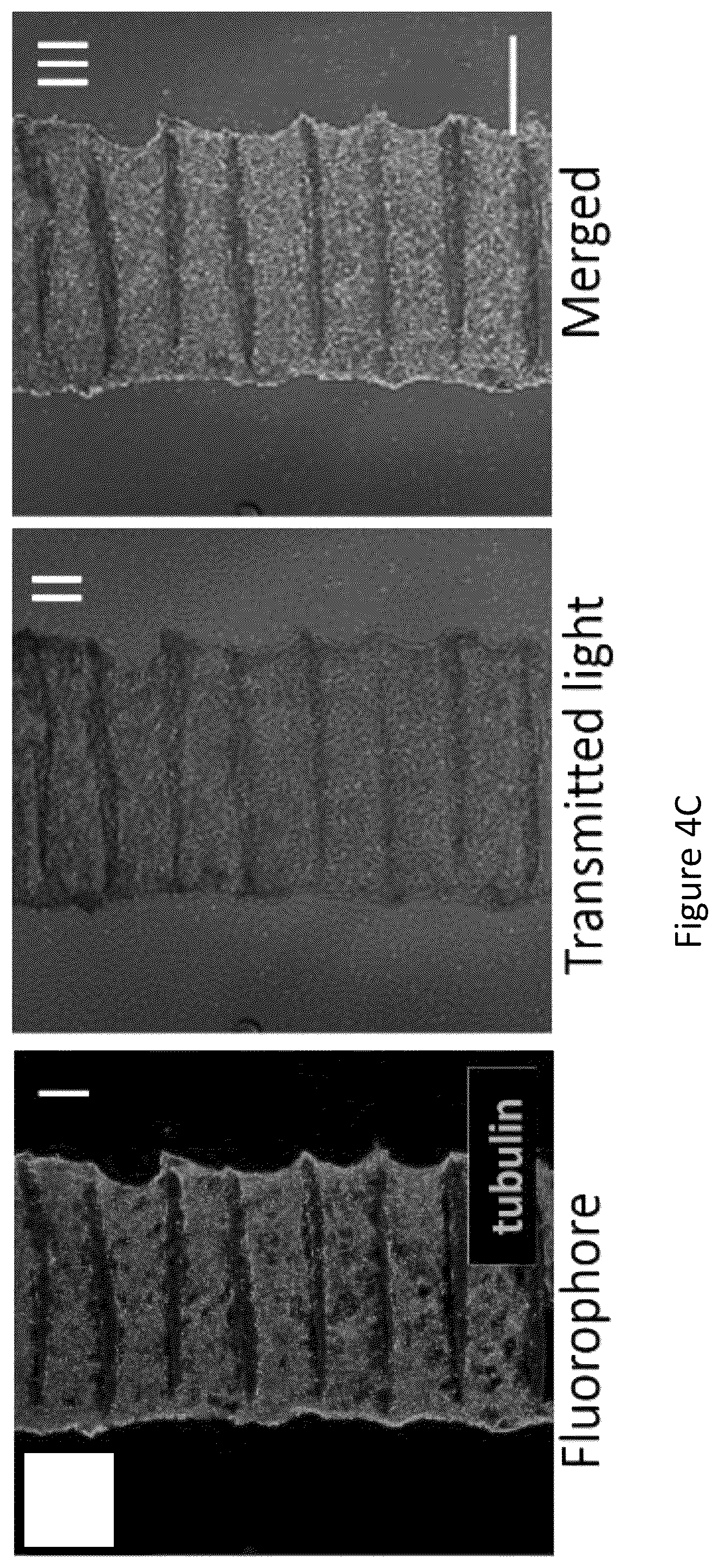Patent US12304151 Figure 15 – 3D printed biodegradable implants