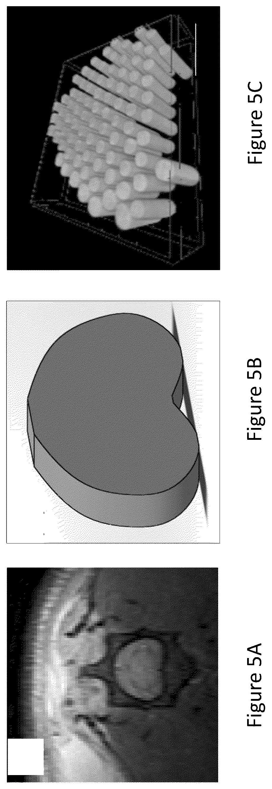 Patent US12304151 Figure 18 – 3D printed biodegradable implants