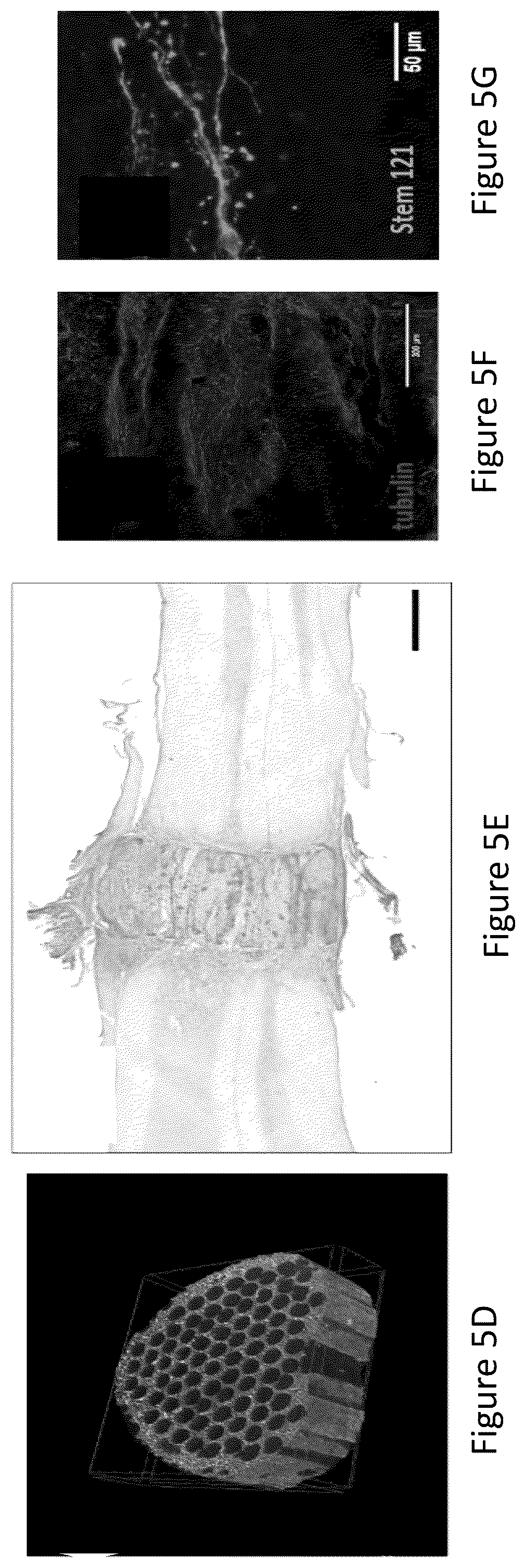 Patent US12304151 Figure 19 – 3D printed biodegradable implants