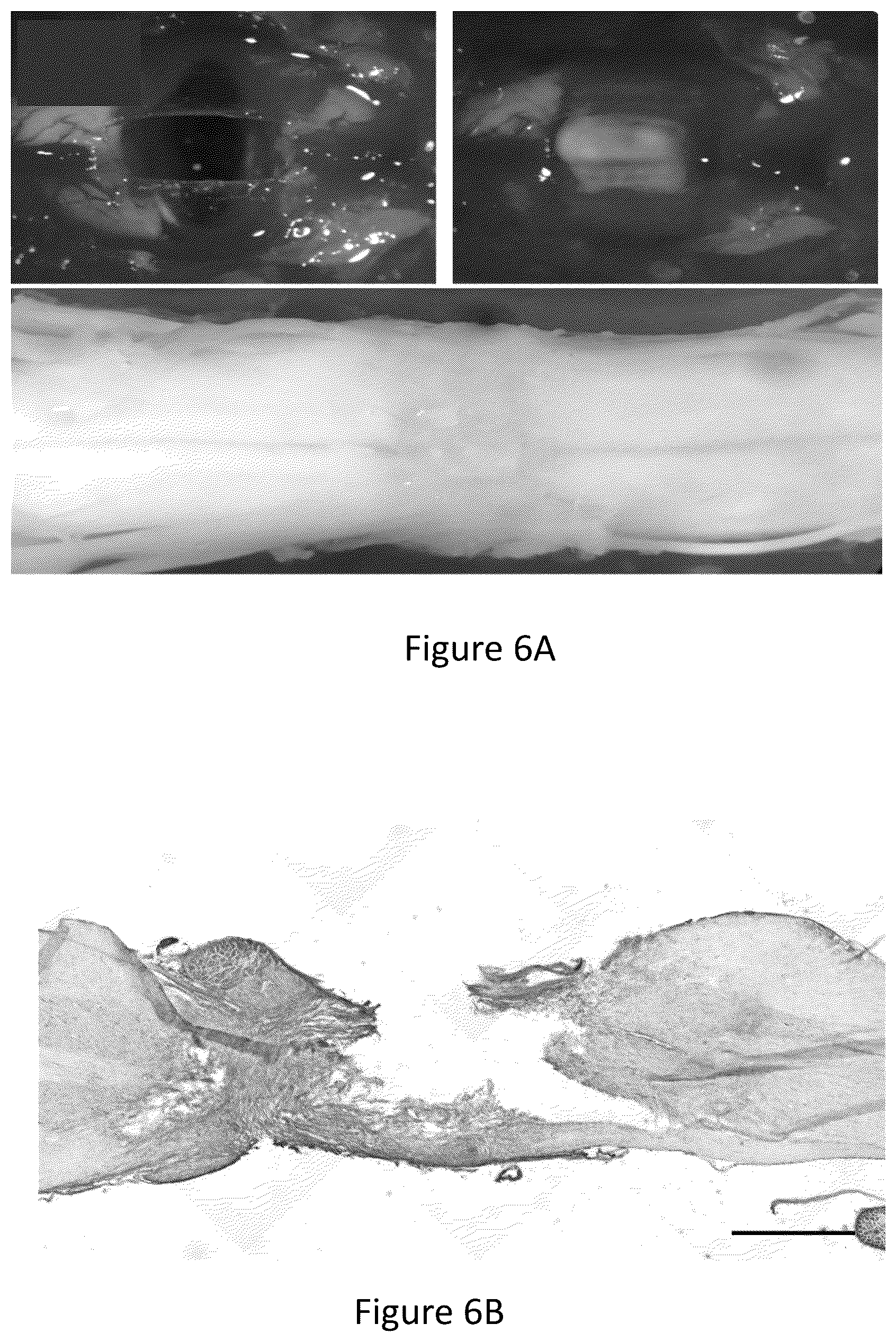 Patent US12304151 Figure 20 – 3D printed biodegradable implants