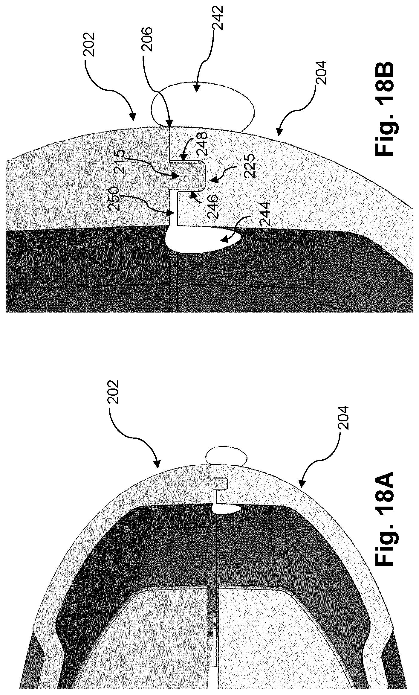 Patent US12304152 Figure 18 – Ultrasound probe handle