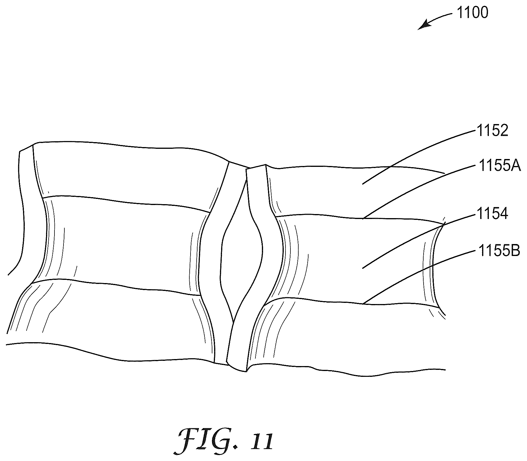 Patent US12304186 Figure 14 – Co-extruded multilayer articles including continuous layer and discontinuous layer