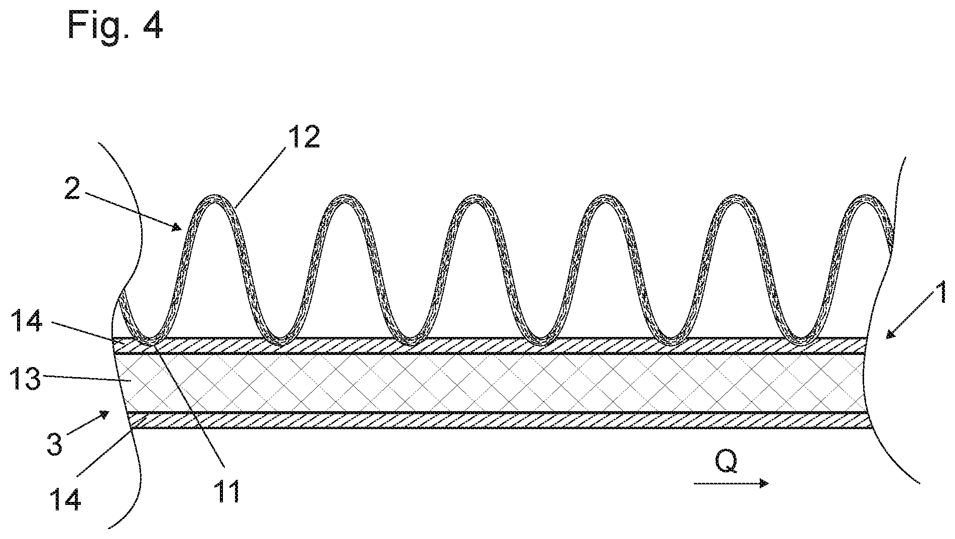 Patent US12304187 Figure 4 – Method for producing an elastic laminate, and laminate obtainable according to said method