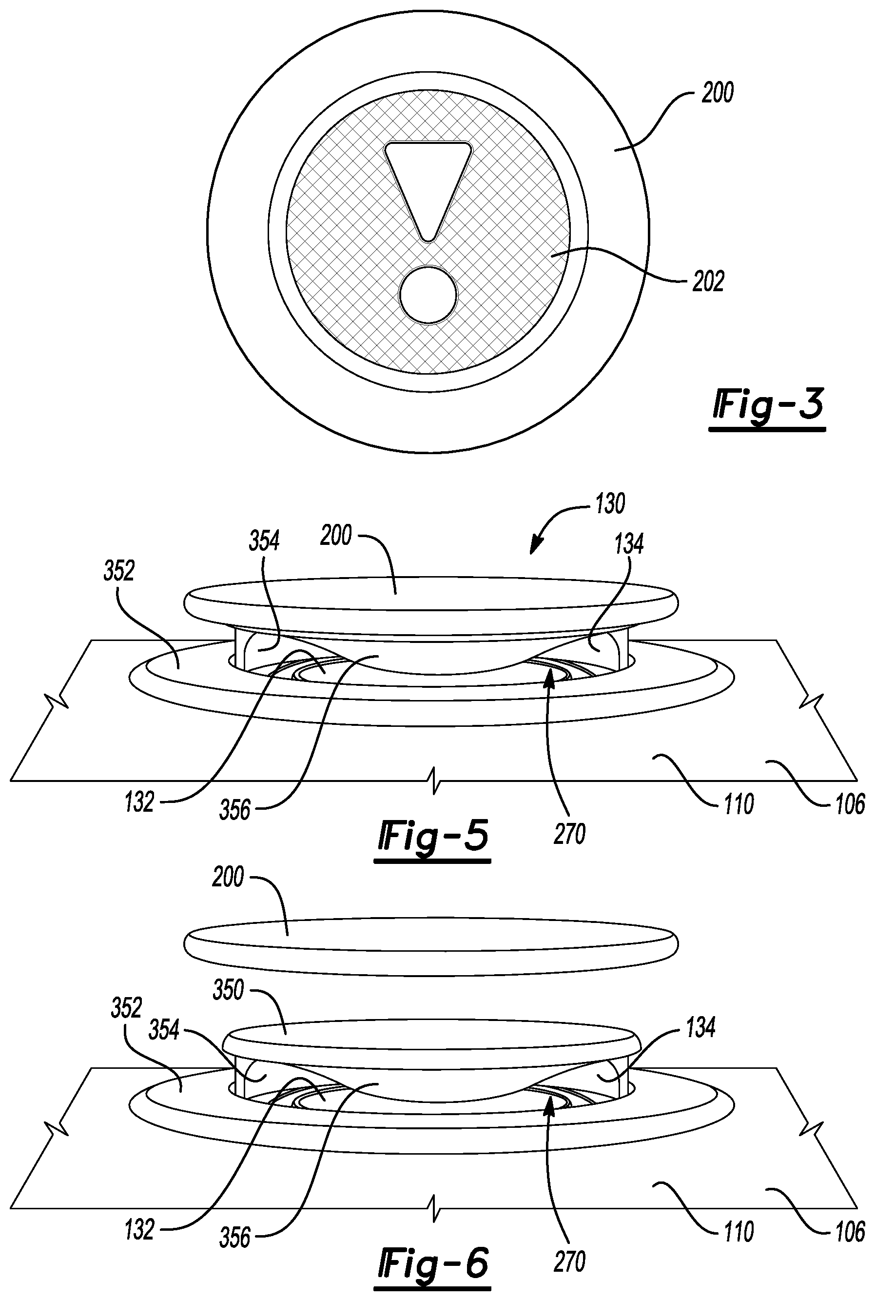 Patent US12304373 Figure 2 – Side-firing headrest loudspeaker with omnidirectional lens