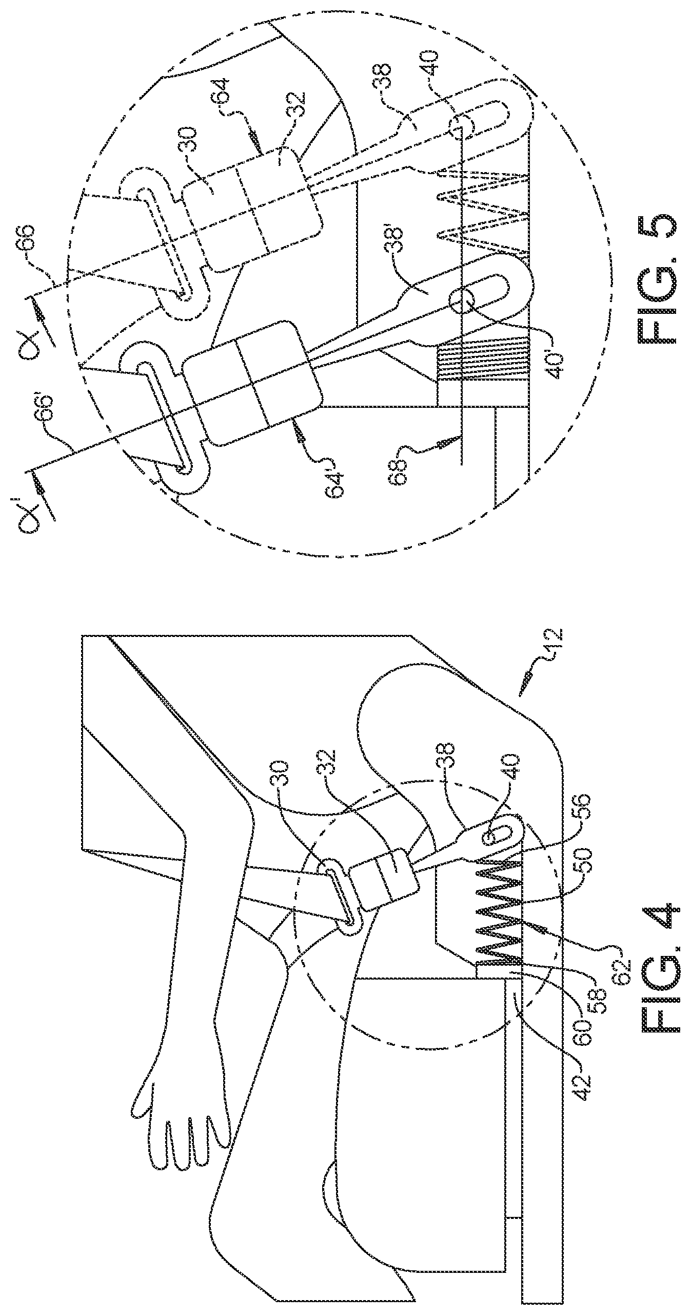 Patent US12304419 Figure 2 – Seatbelt anchorage with energy absorption for frontal impact protection