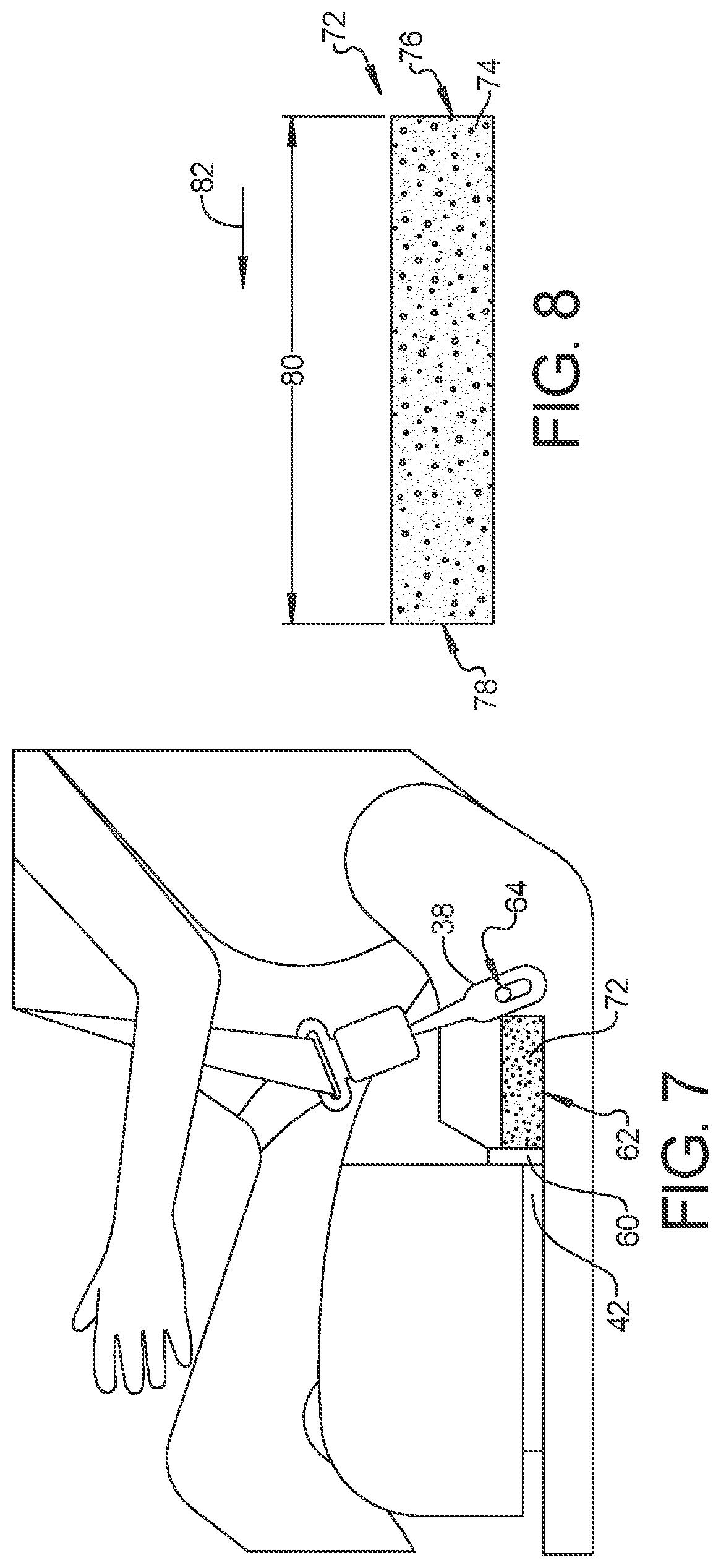 Patent US12304419 Figure 4 – Seatbelt anchorage with energy absorption for frontal impact protection