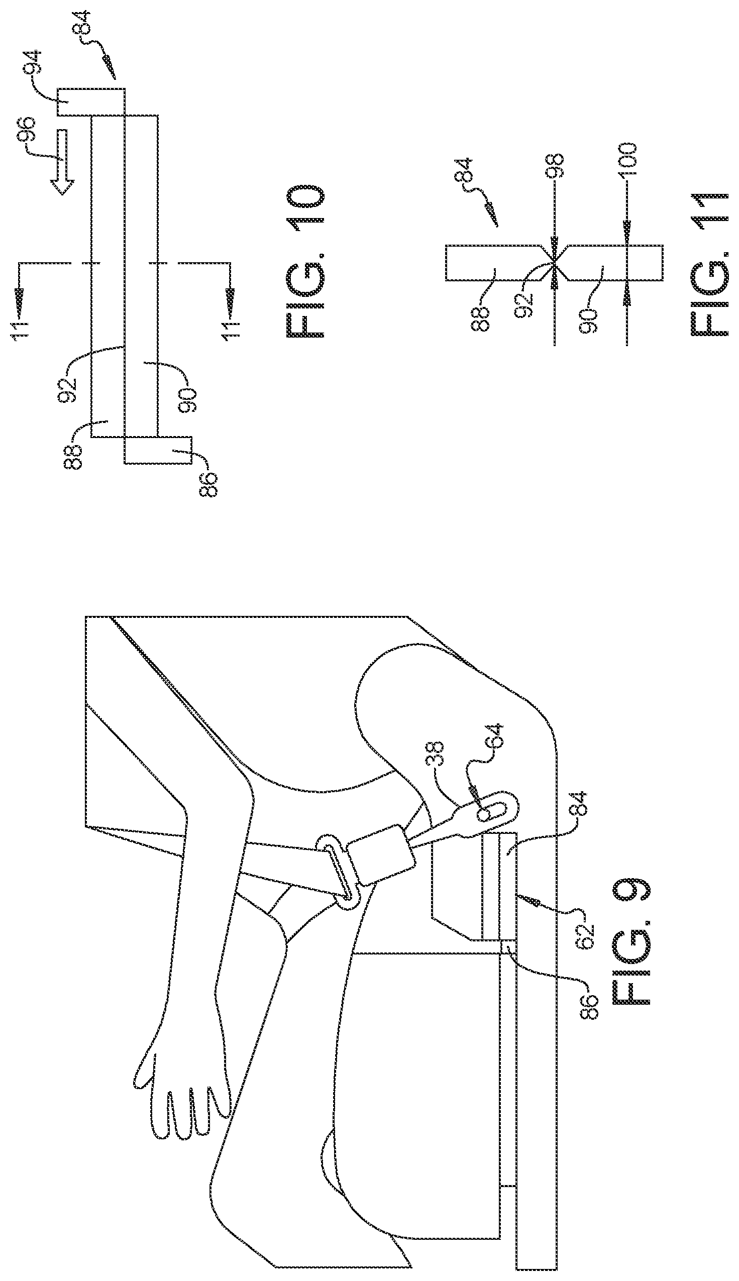 Patent US12304419 Figure 5 – Seatbelt anchorage with energy absorption for frontal impact protection