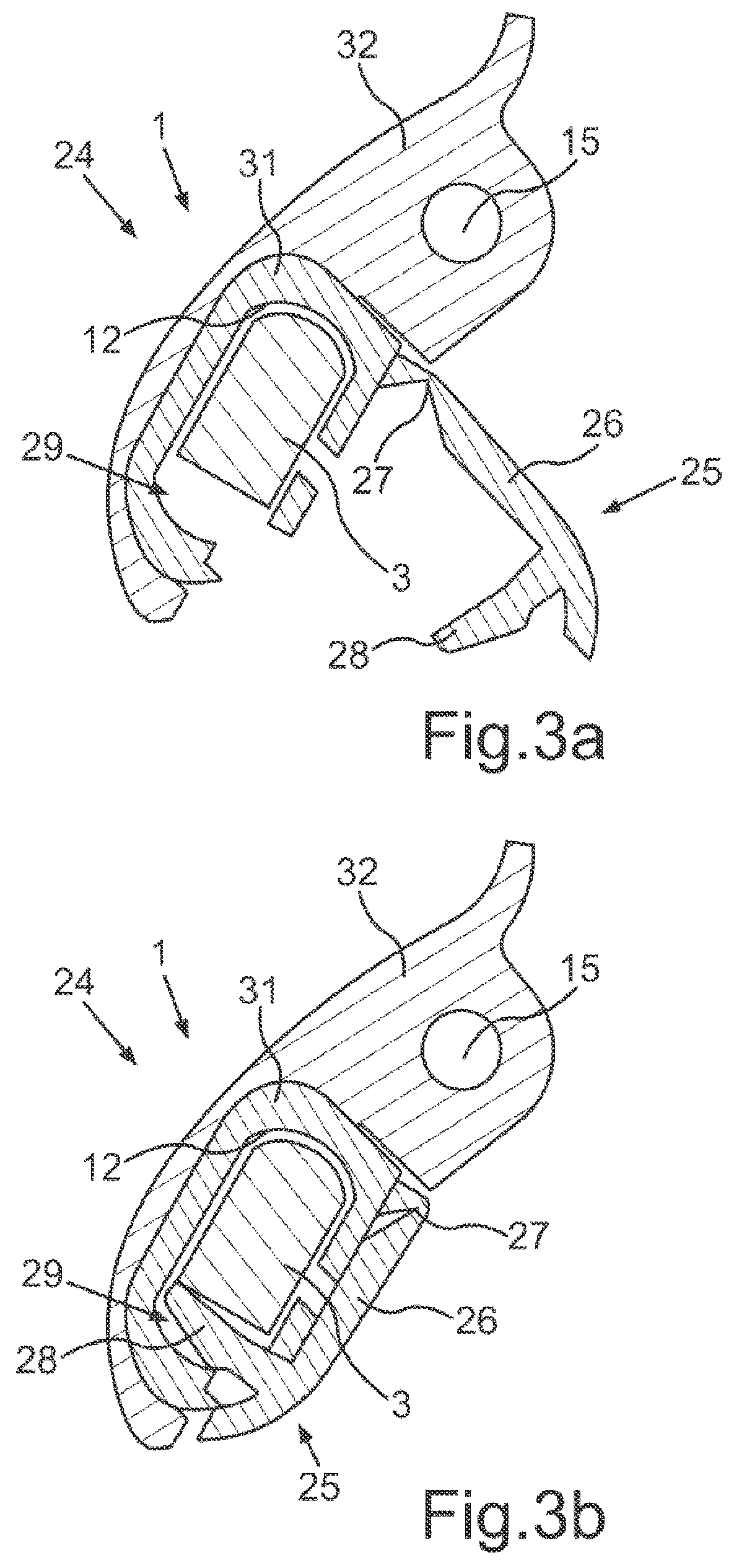 Patent US12304432 Figure 3 – Wind deflector for a windscreen wiper system of a motor vehicle