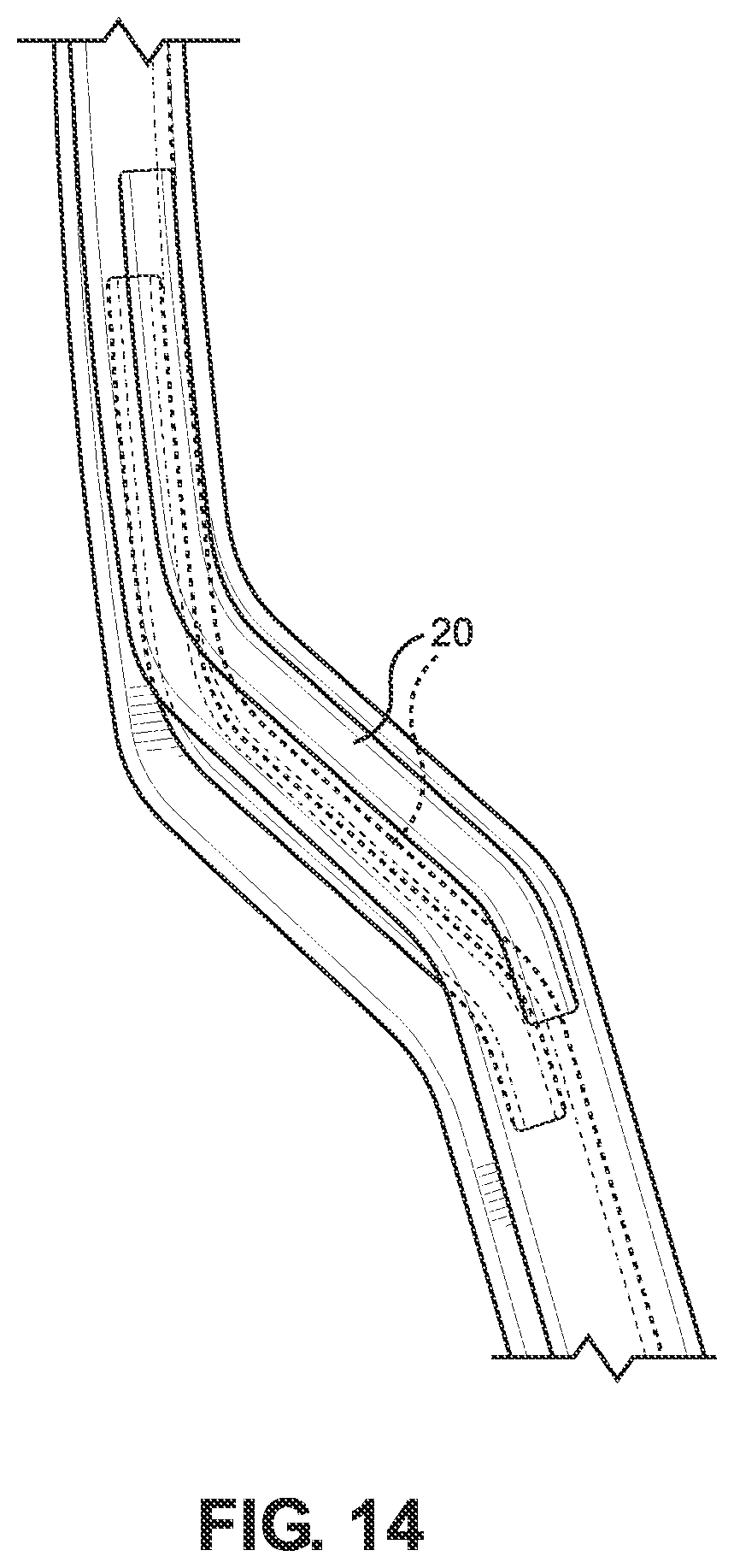 Patent US12304704 Figure 11 – Stackable eye shields