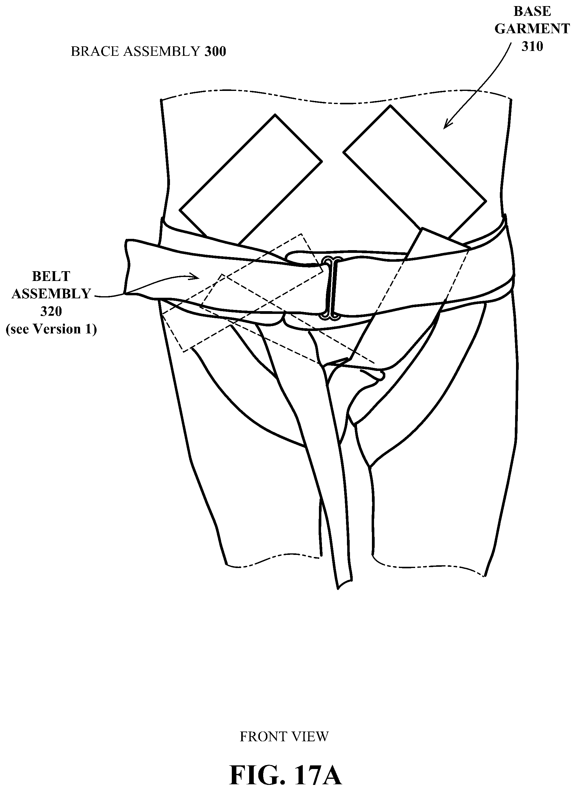 Patent US12304758 Figure 17 – Pelvic braces and methods for using same