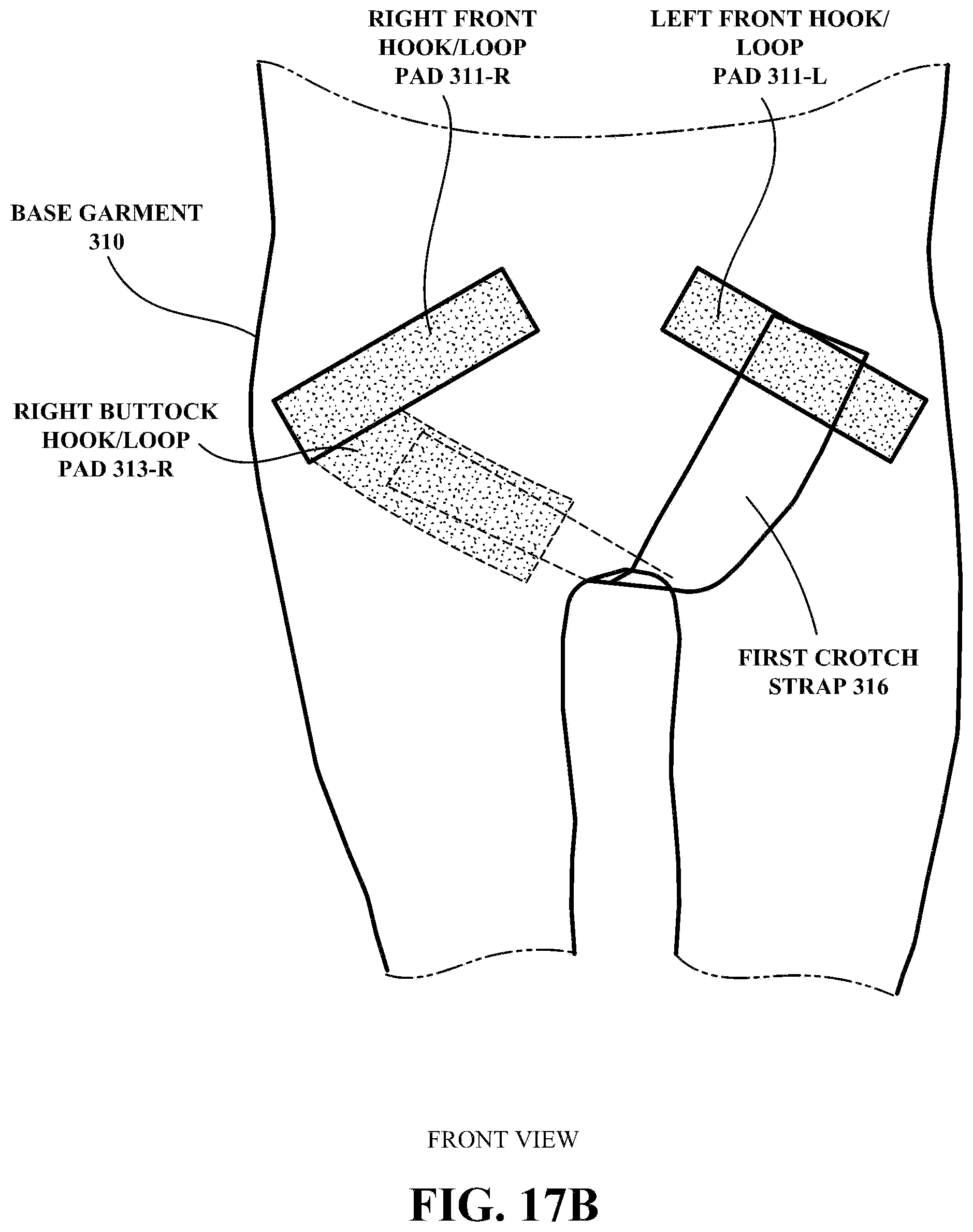 Patent US12304758 Figure 18 – Pelvic braces and methods for using same