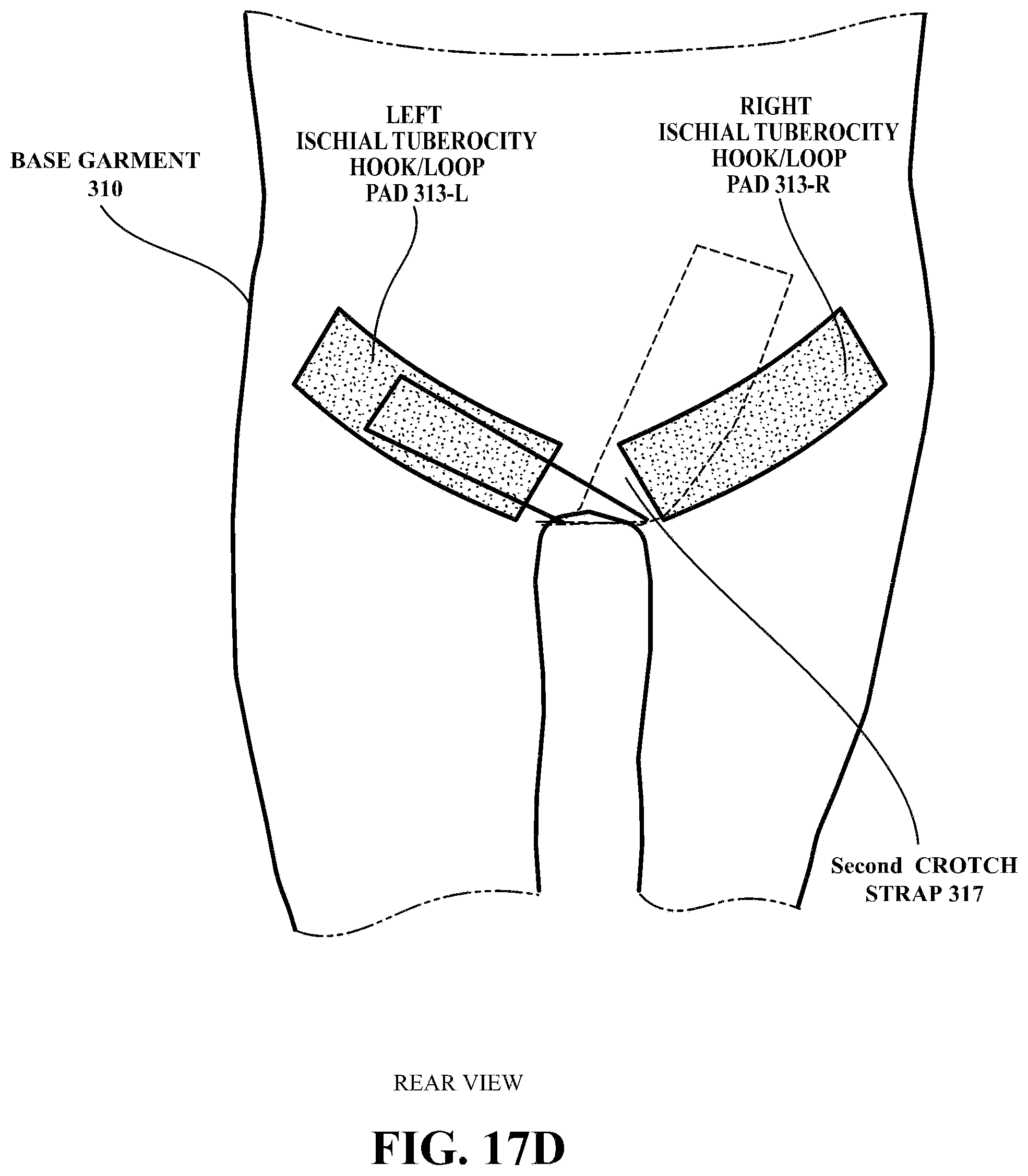 Patent US12304758 Figure 20 – Pelvic braces and methods for using same