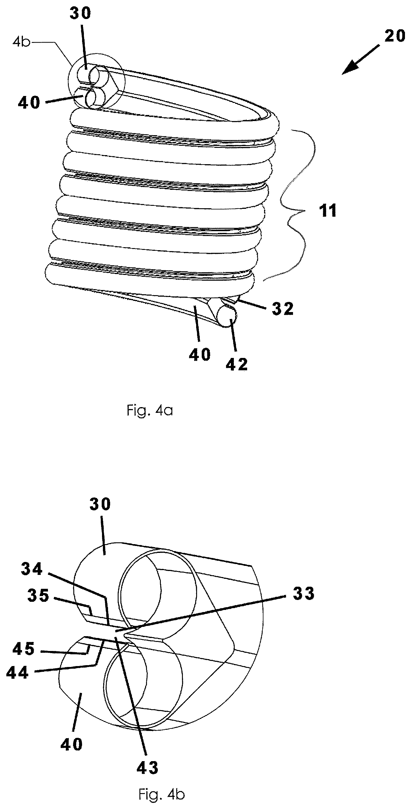 Patent US12304770 Figure 4 – Coiled sheath system