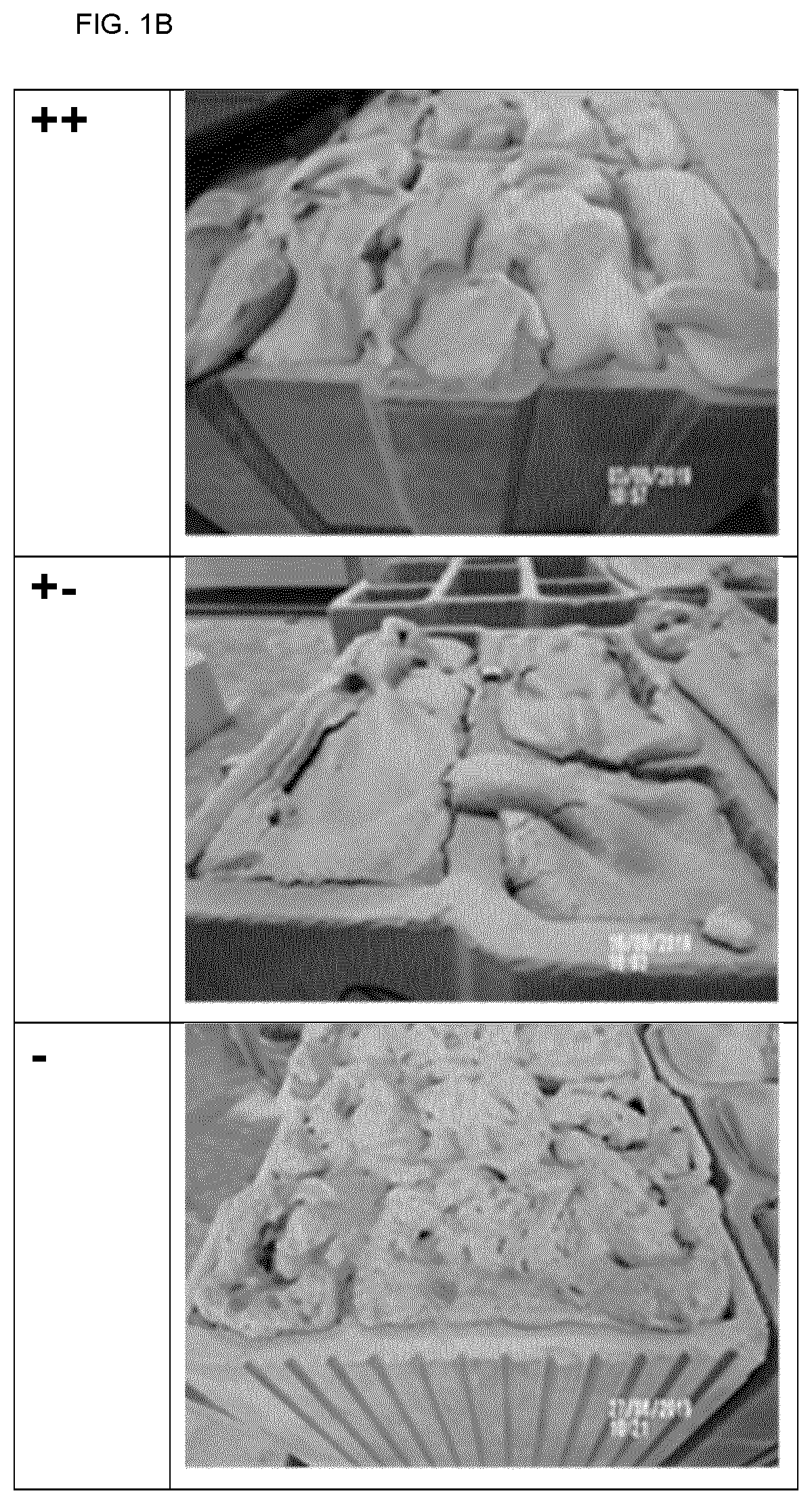 Patent US12304872 Figure 2 – Method for producing a composite insulating mineral construction element