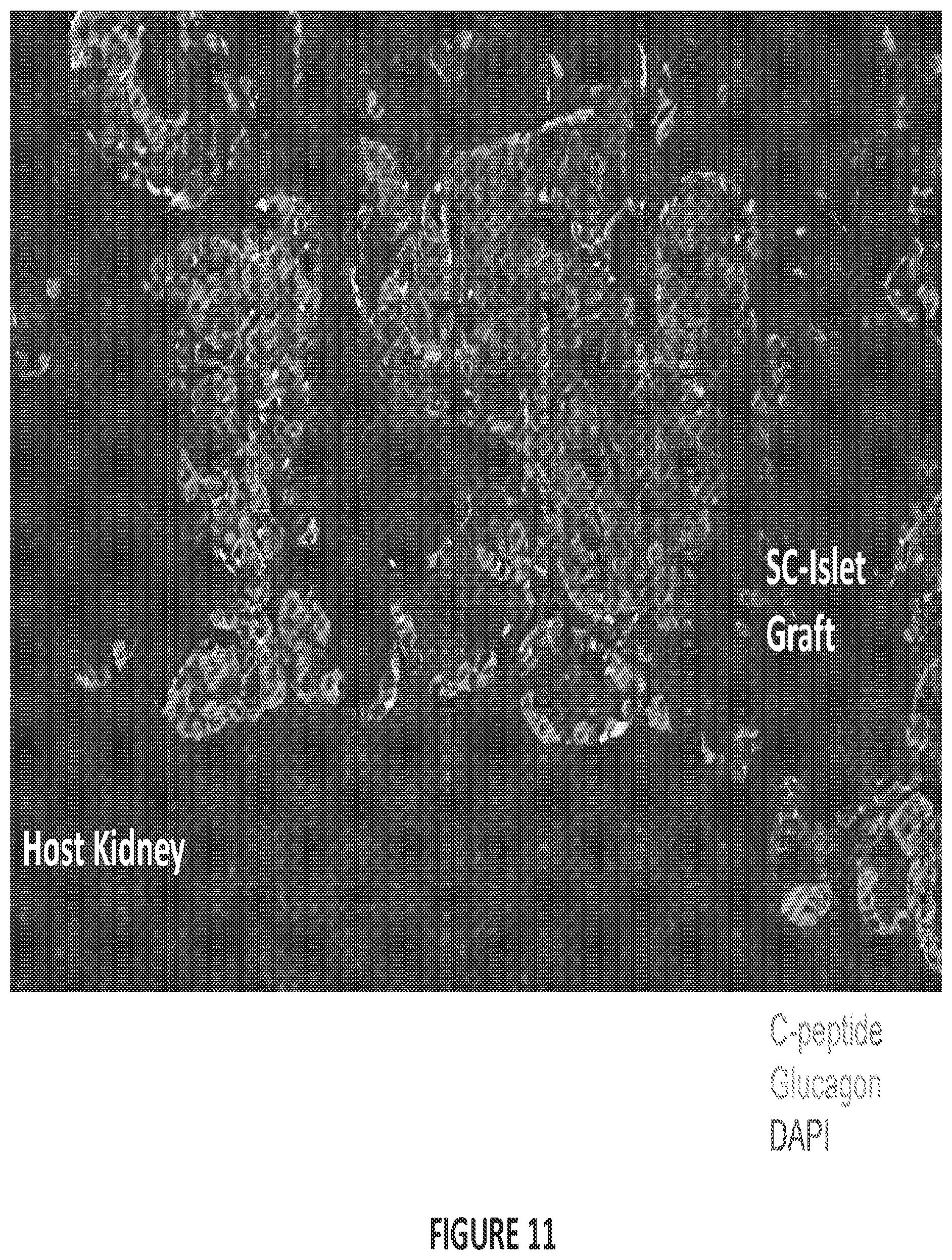 Patent US12304900 Figure 14 – Islet cell manufacturing compositions and methods of use