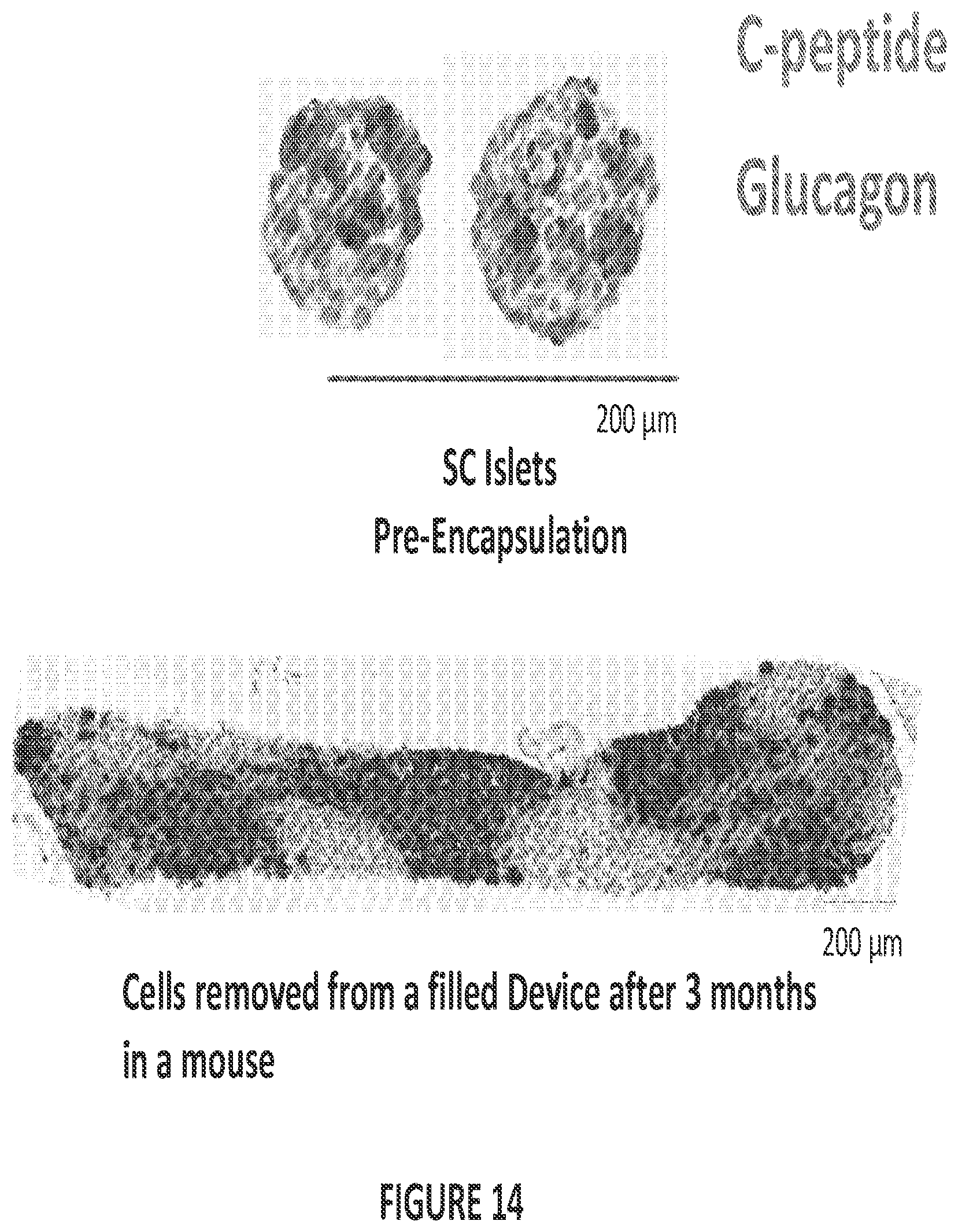Patent US12304900 Figure 17 – Islet cell manufacturing compositions and methods of use