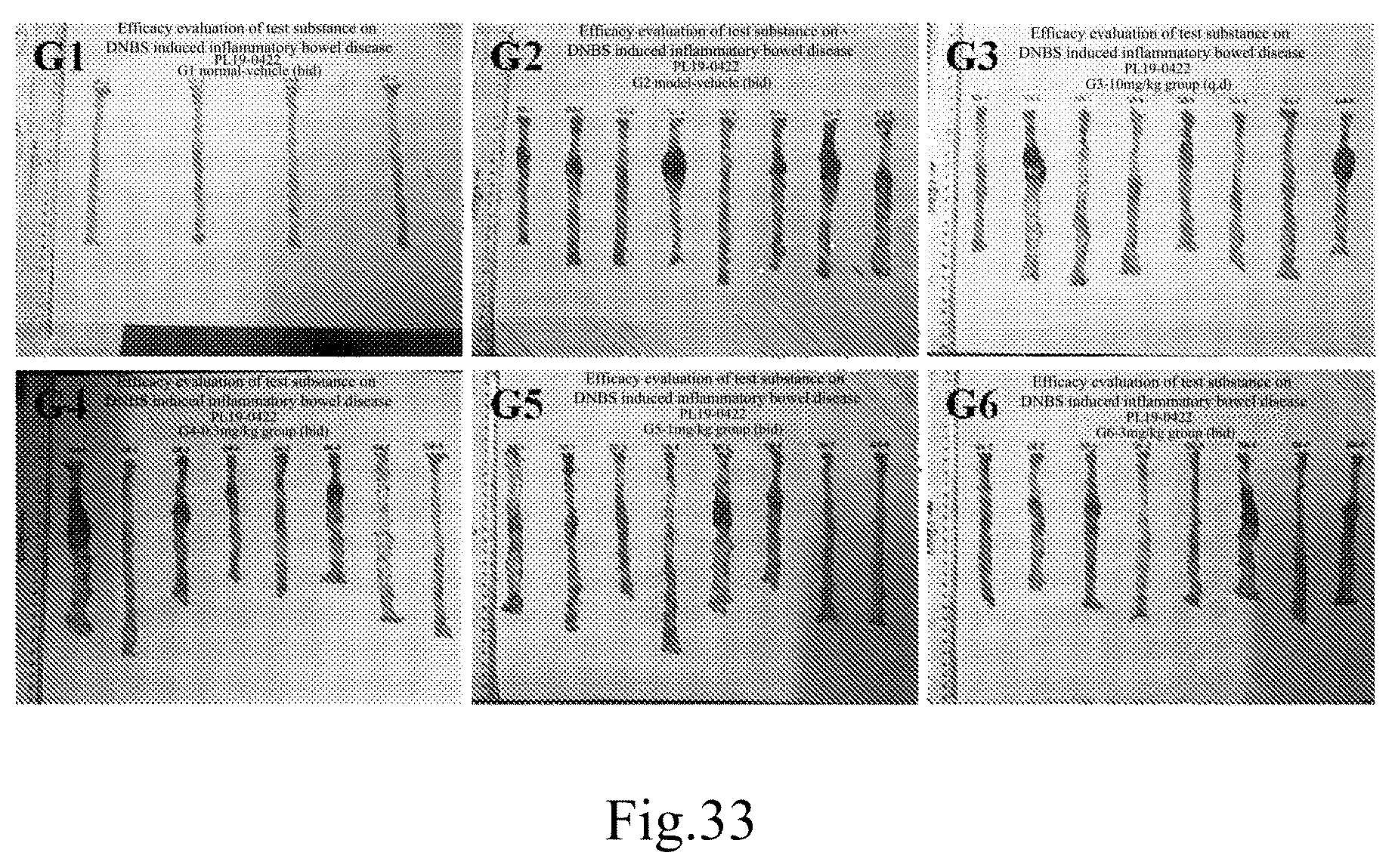 Patent US12304910 Figure 17 – Janus kinase (JAK) family inhibitor, preparation of same, and applications thereof