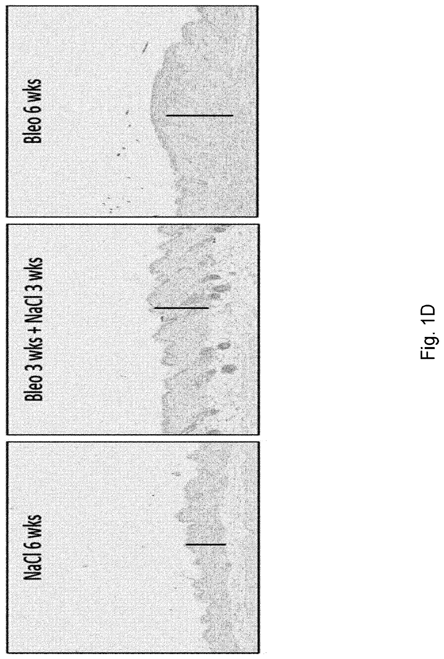 Patent US12304949 Figure 4 – Anti-S100A4 humanized antibodies, uses and methods