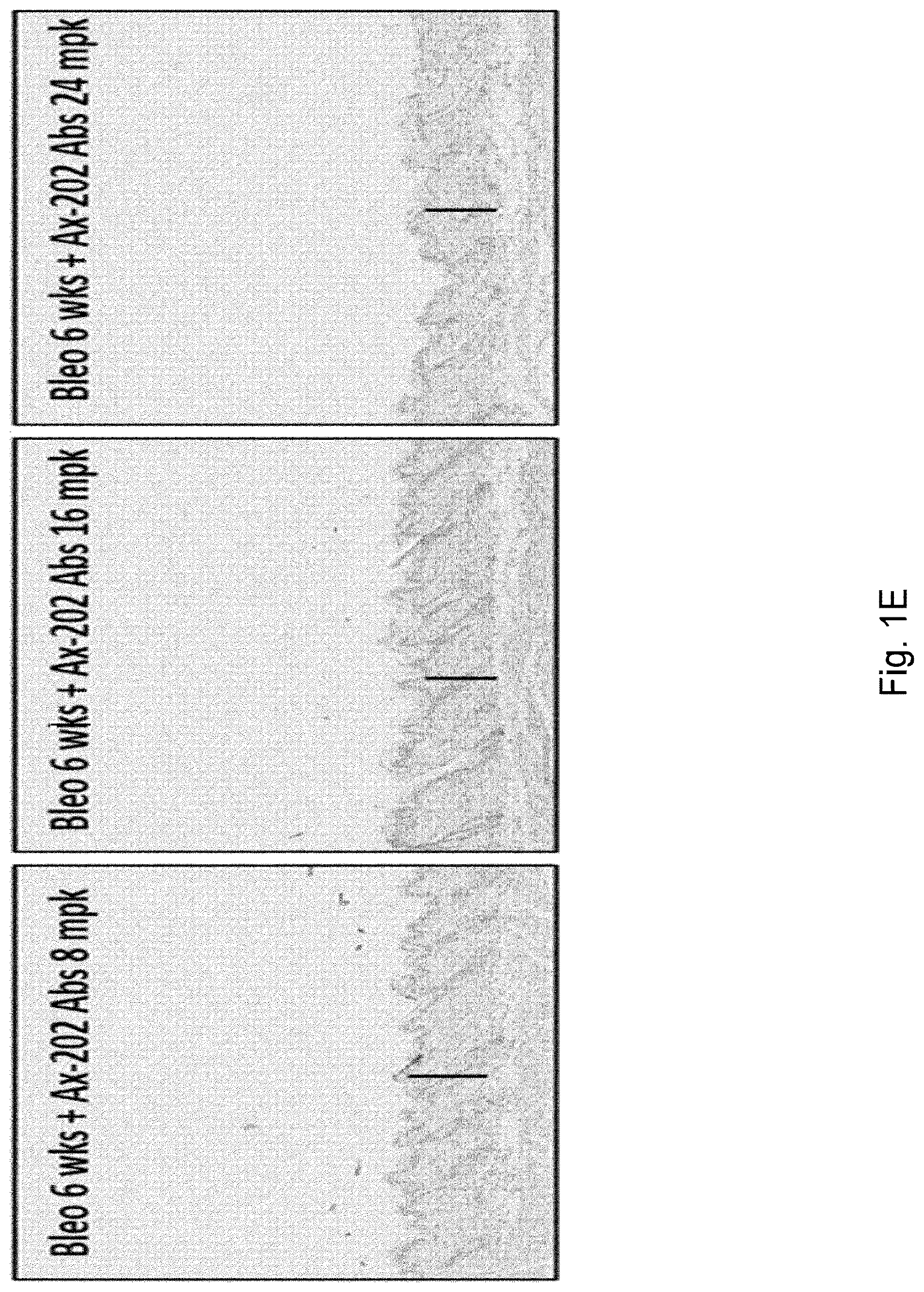 Patent US12304949 Figure 5 – Anti-S100A4 humanized antibodies, uses and methods
