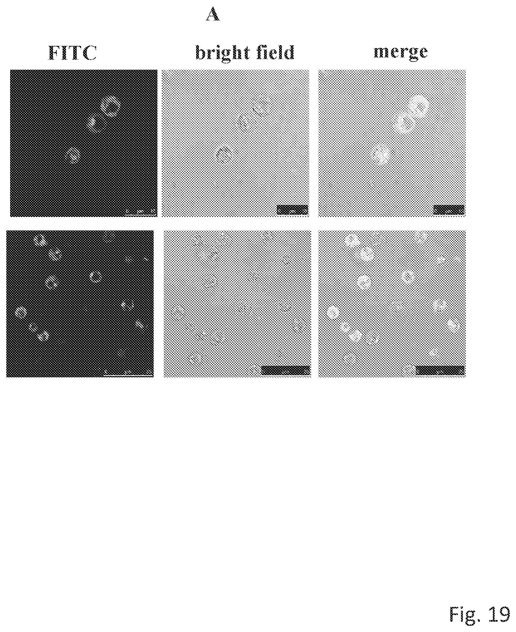 Patent US12304963 Figure 19 – Antibody complex and uses thereof