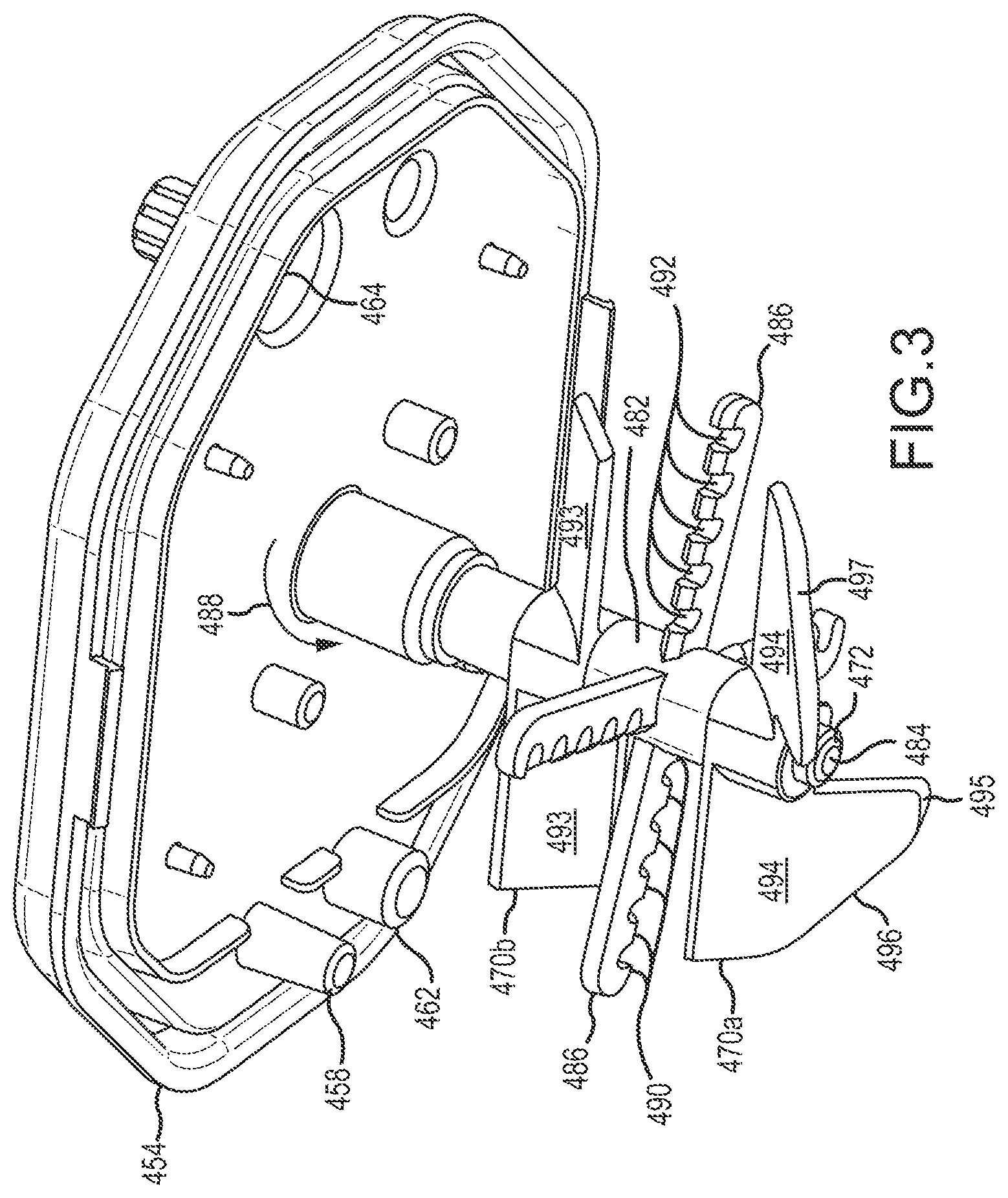 Patent US12305159 Figure 3 – Tissue processing apparatus and method for processing adipose tissue