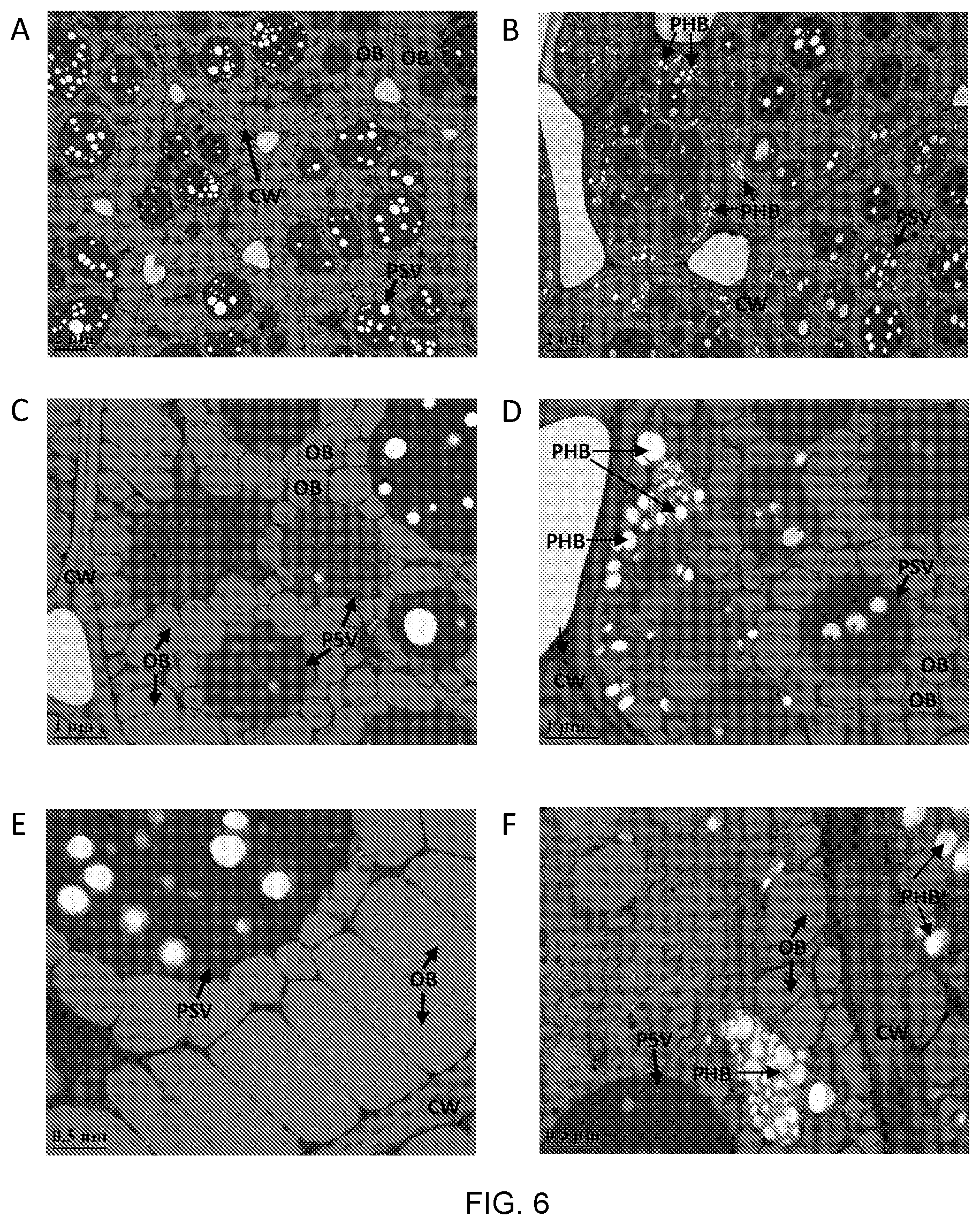 Patent US12305179 Figure 19 – Transgenic land plants that express a polyhydroxyalkanoate synthase seed specifically with cytosolic localization