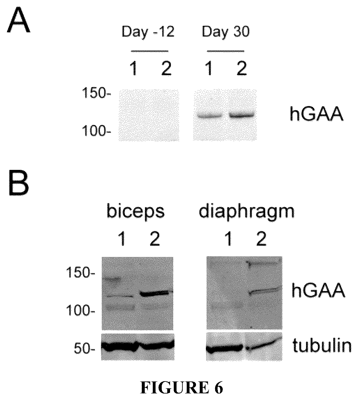 Patent US12305187 Figure 6 – Acid-alpha glucosidase variants and uses thereof