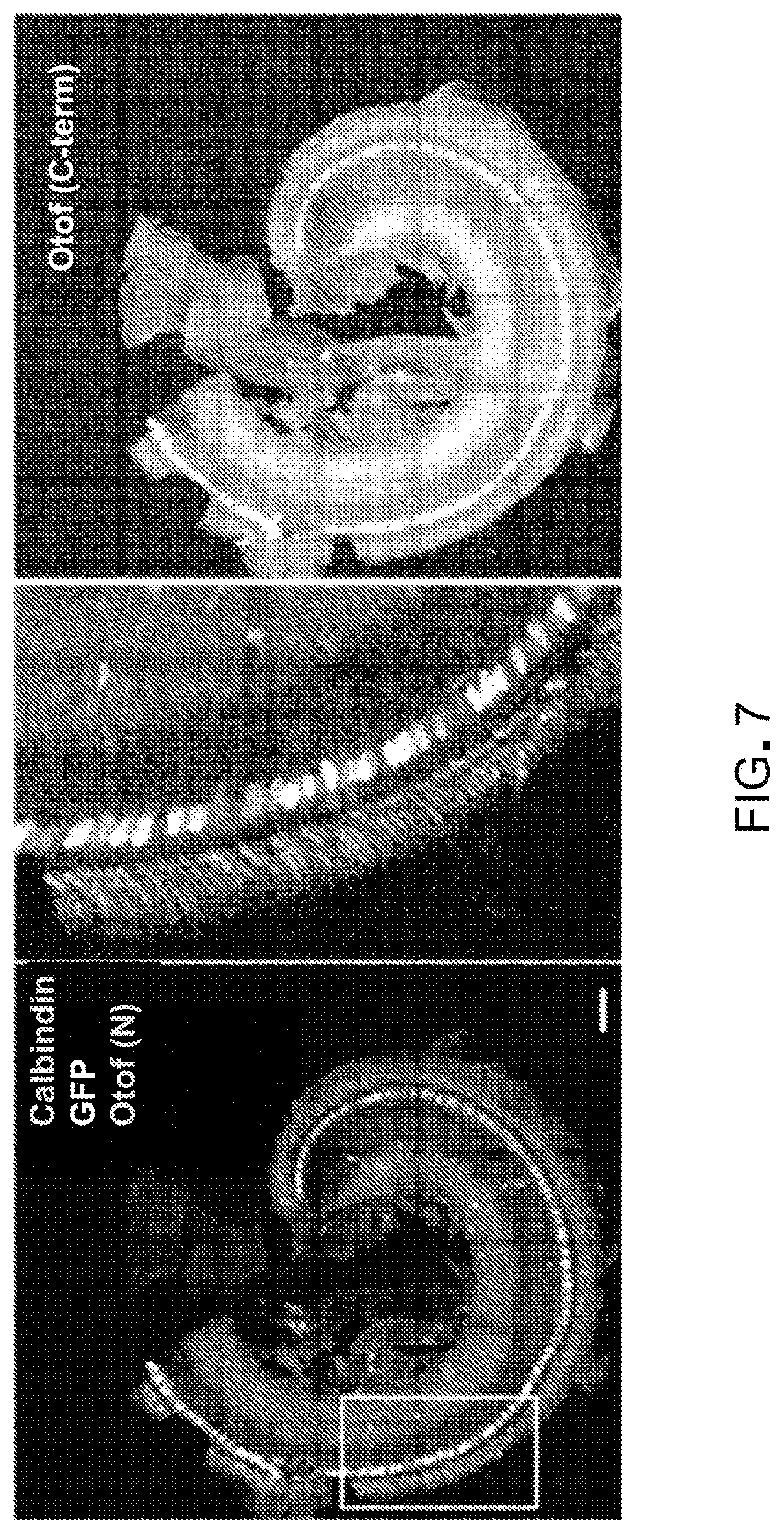 Patent US12305191 Figure 5 – Compositions and methods for treating non-age-associated hearing impairment in a human subject