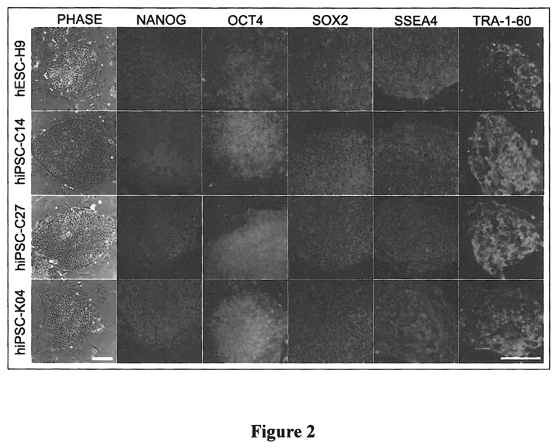Patent US12305195 Figure 2 – Induced pluripotent cell-derived oligodendrocyte progenitor cells for the treatment of myelin disorders