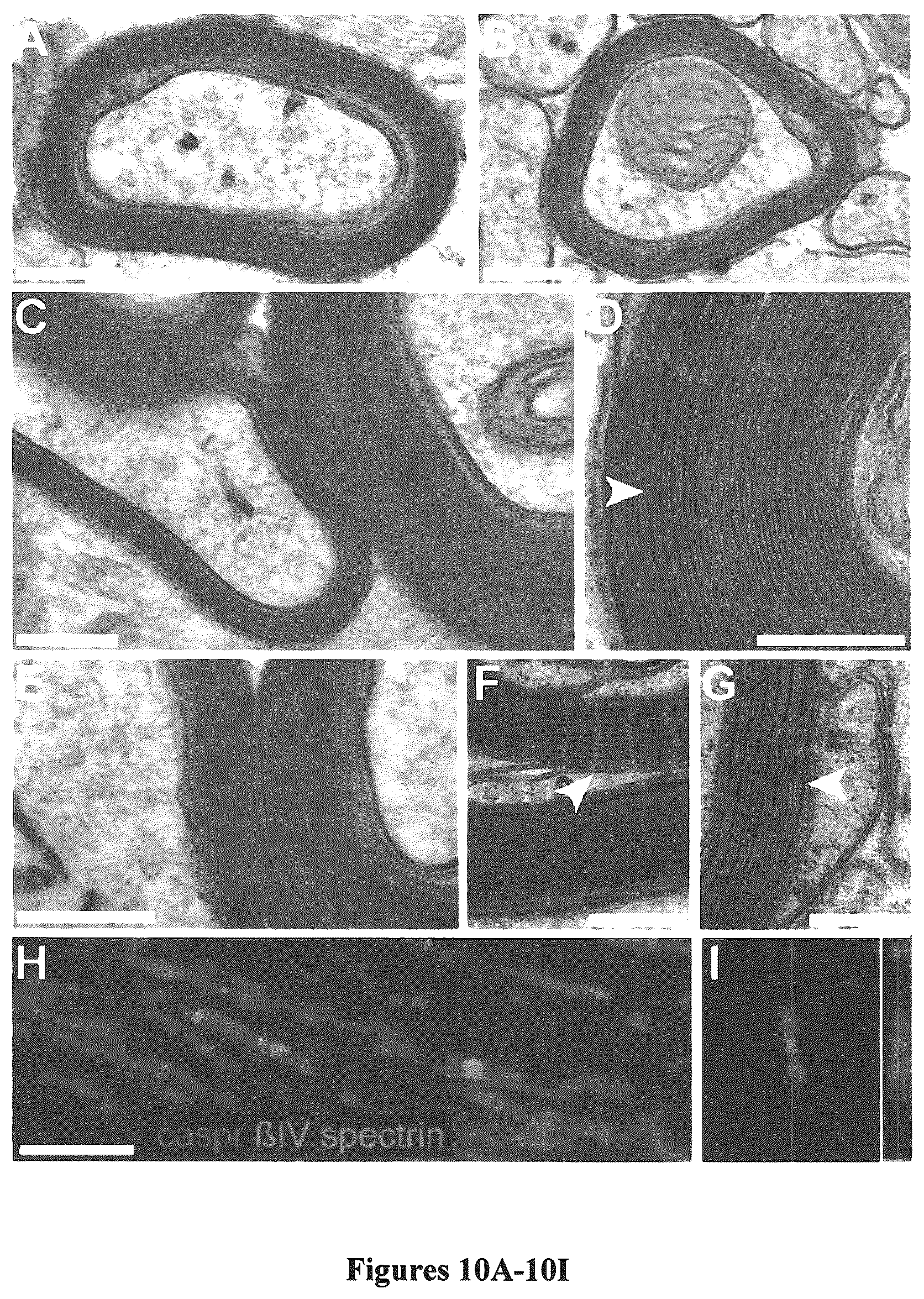 Patent US12305195 Figure 11 – Induced pluripotent cell-derived oligodendrocyte progenitor cells for the treatment of myelin disorders