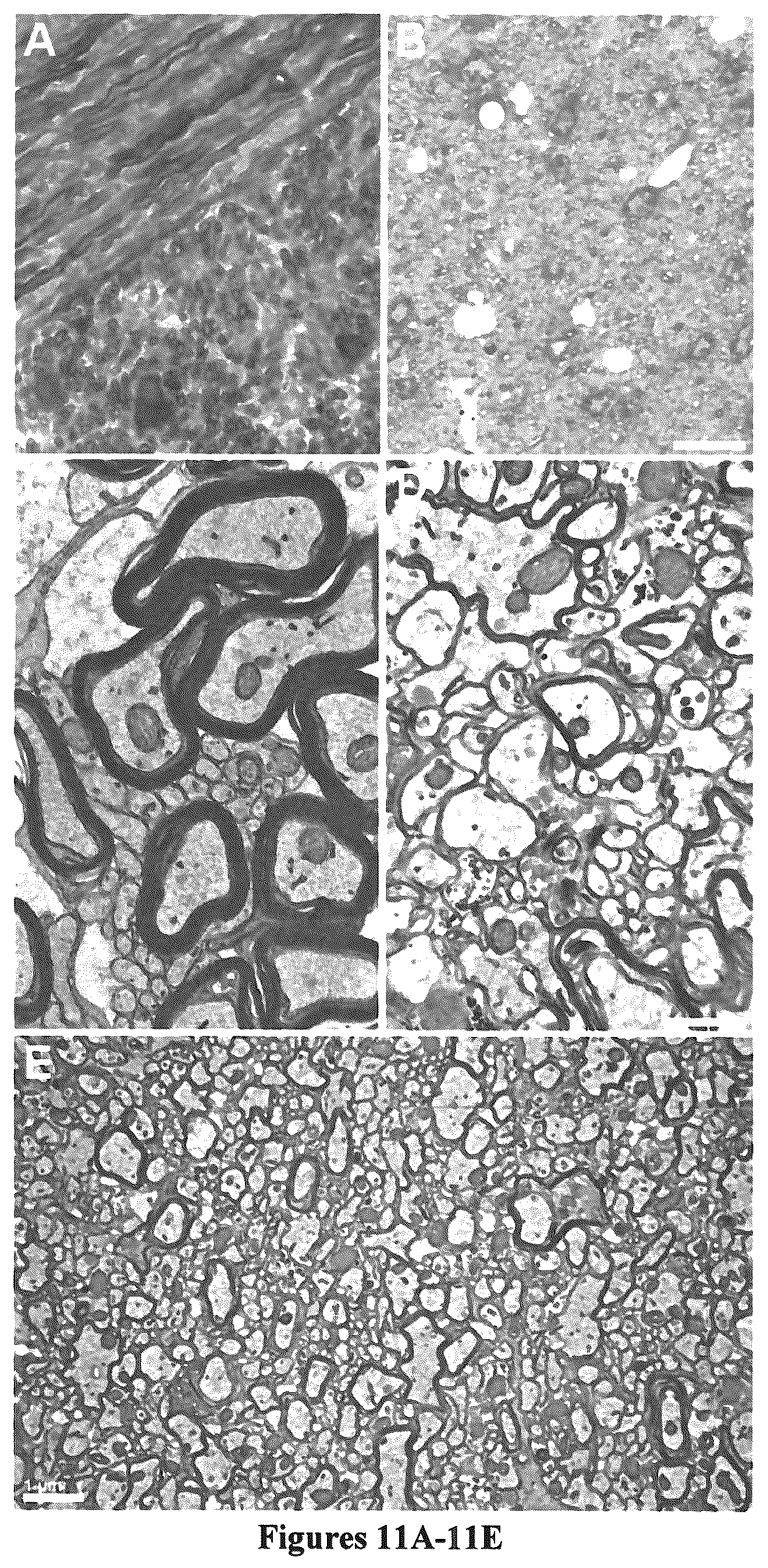 Patent US12305195 Figure 12 – Induced pluripotent cell-derived oligodendrocyte progenitor cells for the treatment of myelin disorders
