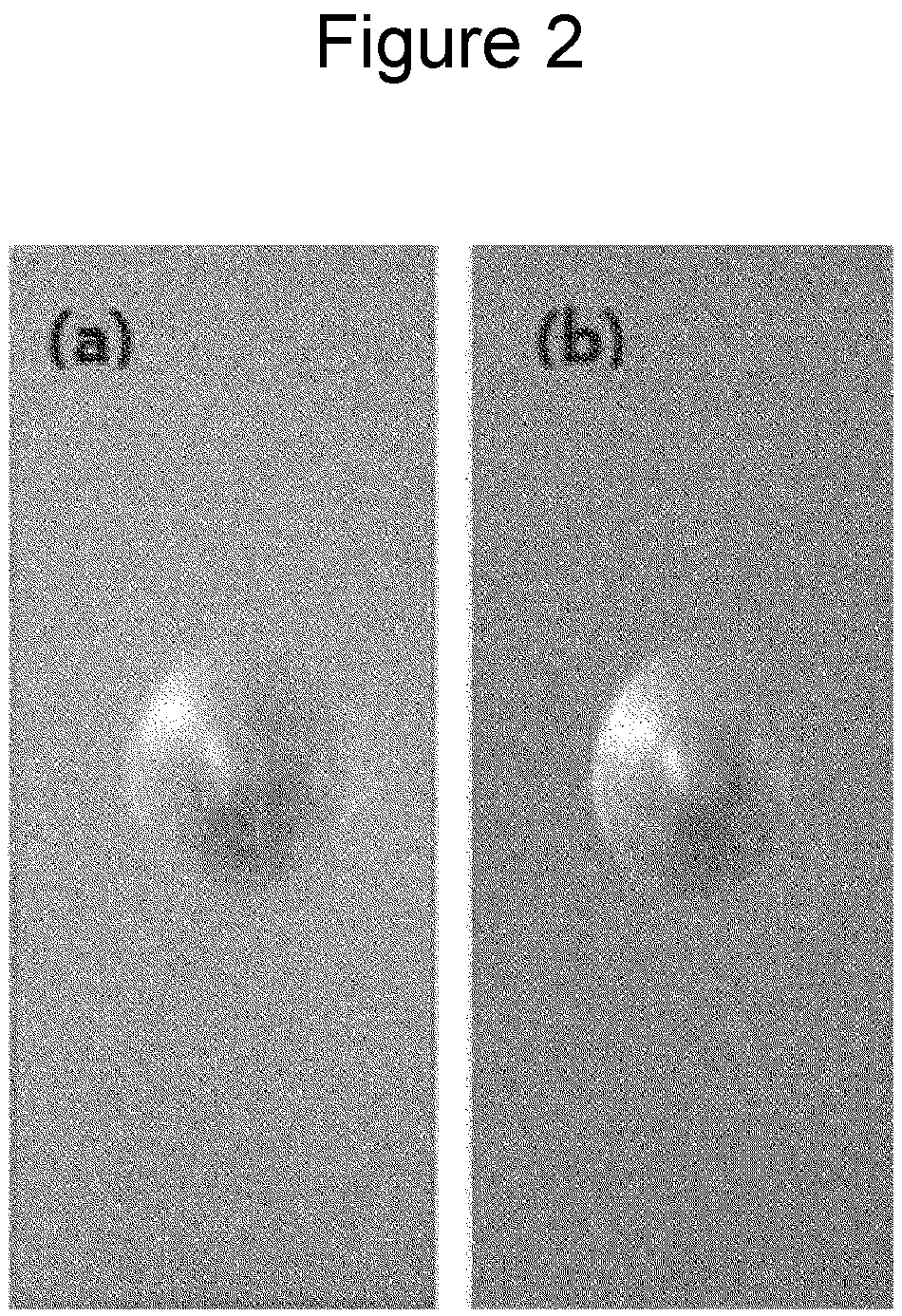 Patent US12305294 Figure 2 – Composition for surface treatment of Mg-containing galvanized steel sheet and Mg-containing galvanized steel sheet surface-treated using same