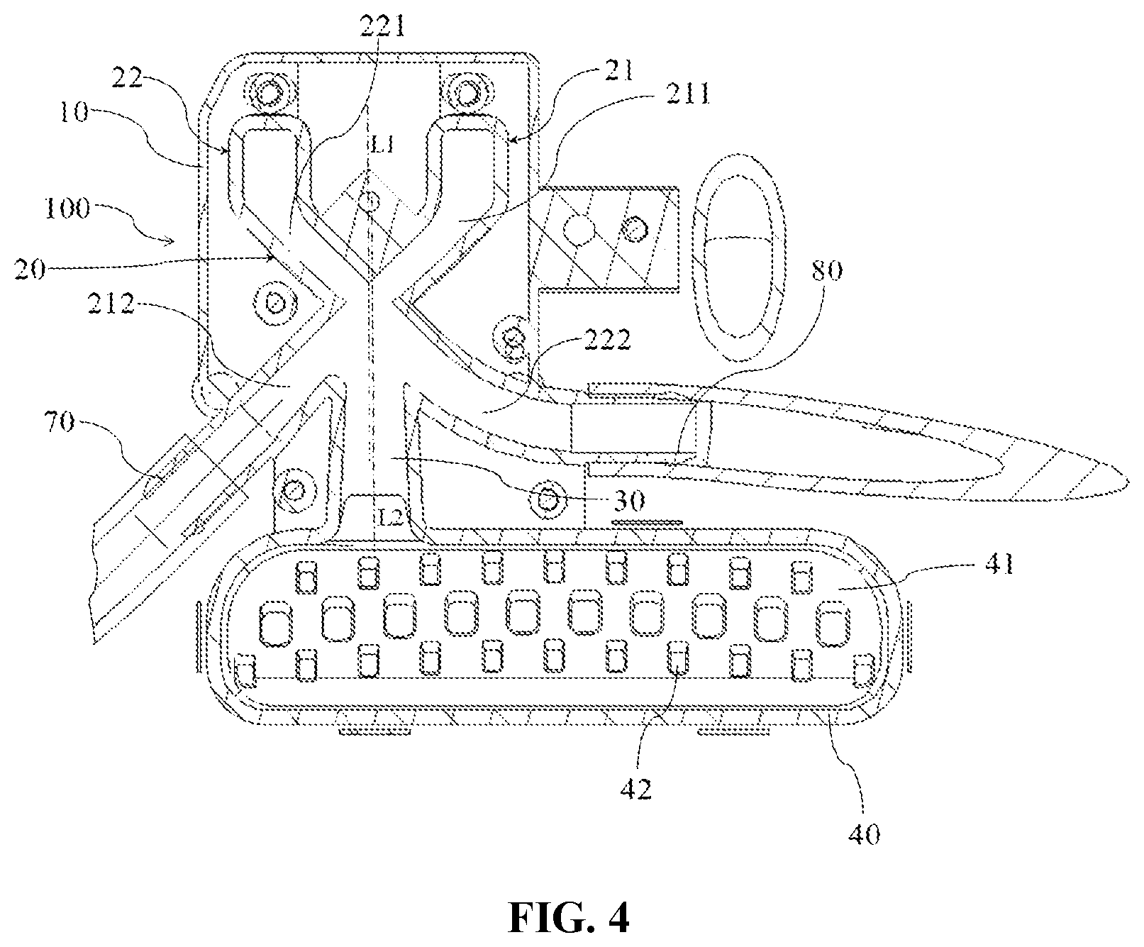 Patent US12305317 Figure 4 – Dispenser, water inlet system, and laundry treatment apparatus