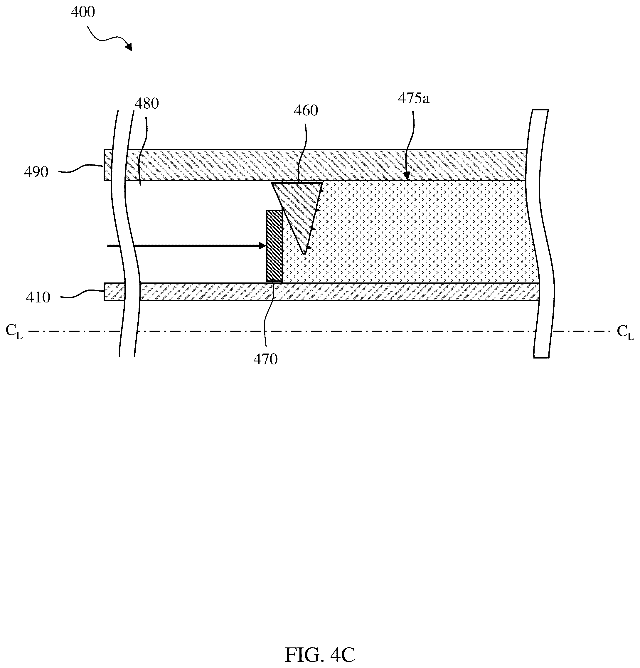 Patent US12305459 Figure 11 – Sealing/anchoring tool employing an expandable metal circlet