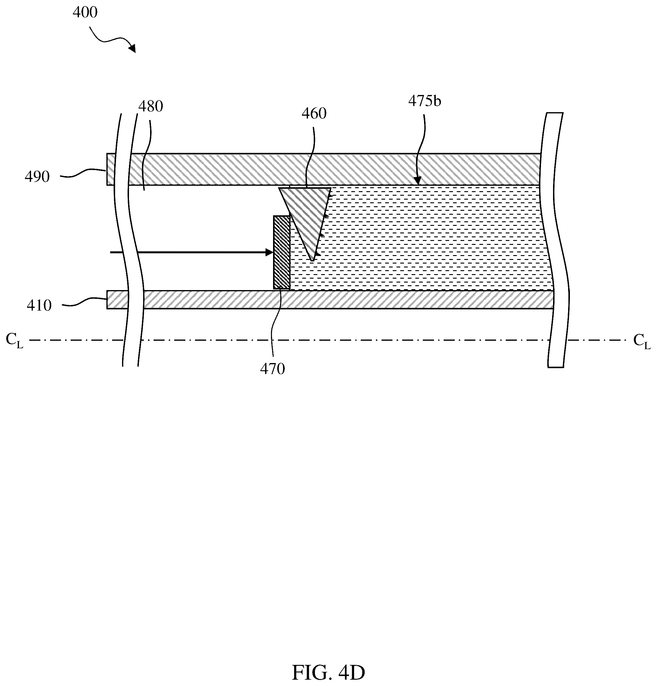 Patent US12305459 Figure 12 – Sealing/anchoring tool employing an expandable metal circlet