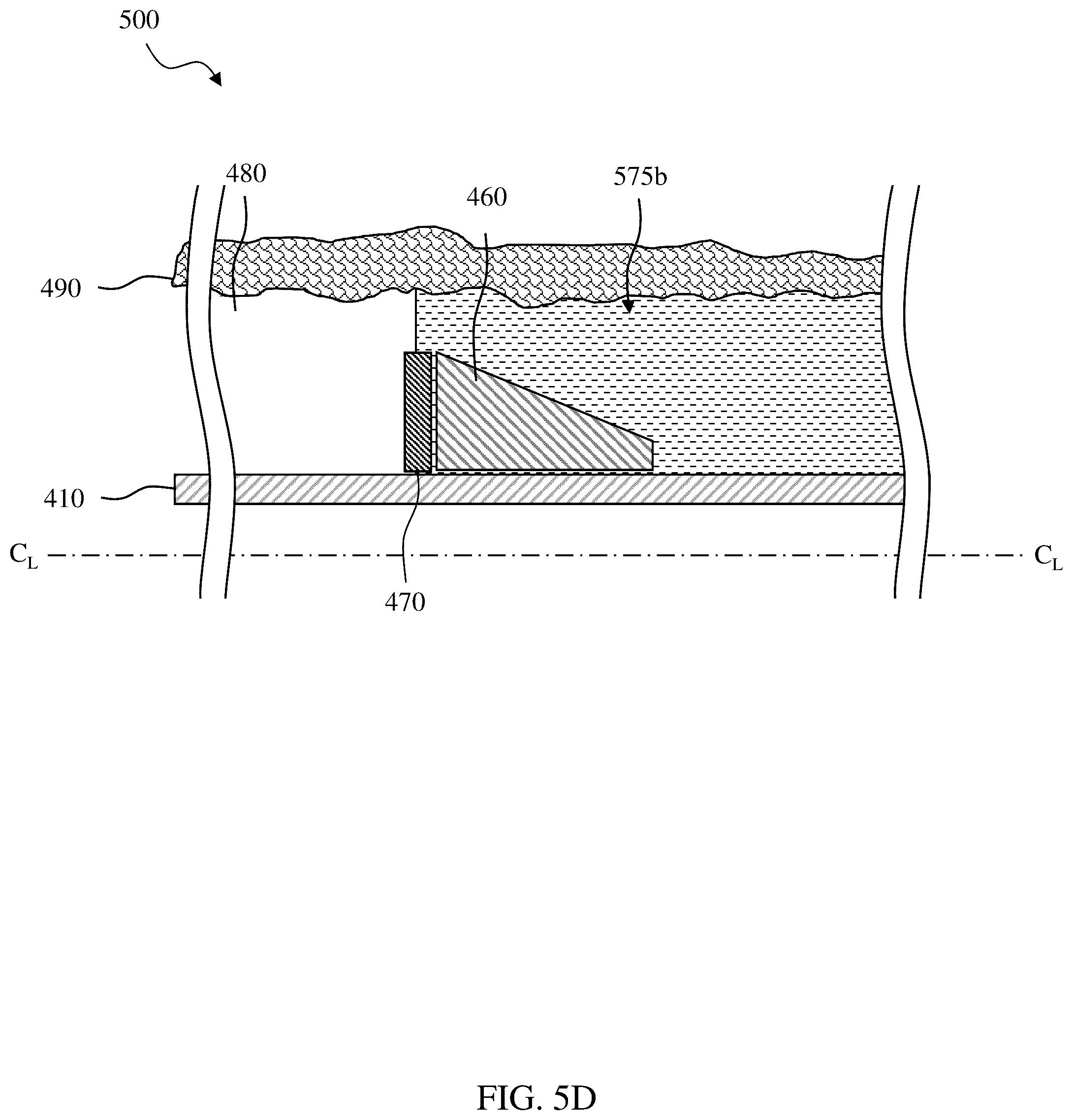 Patent US12305459 Figure 16 – Sealing/anchoring tool employing an expandable metal circlet