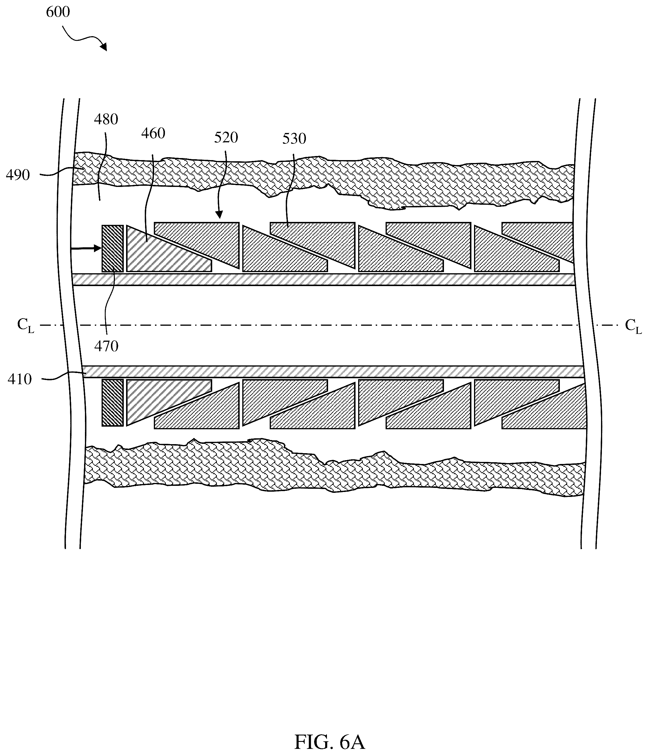 Patent US12305459 Figure 17 – Sealing/anchoring tool employing an expandable metal circlet