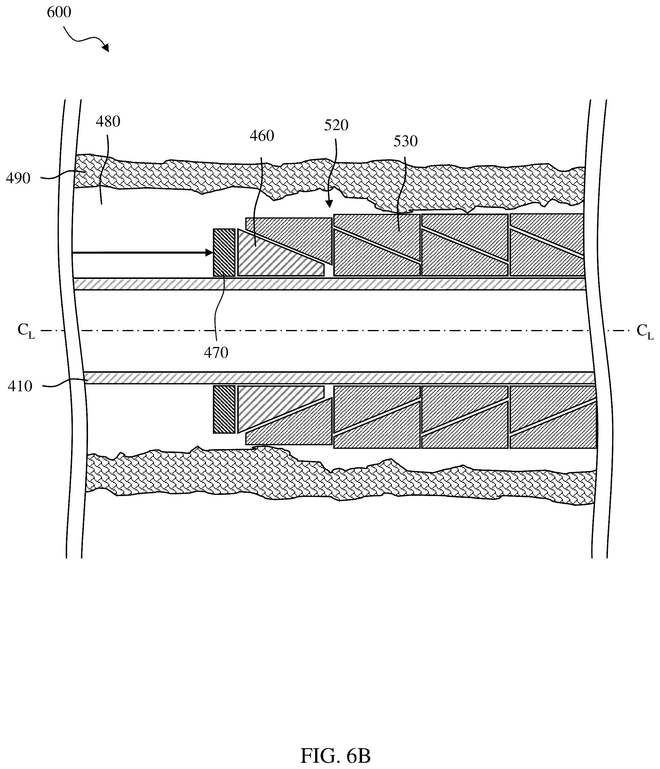Patent US12305459 Figure 18 – Sealing/anchoring tool employing an expandable metal circlet